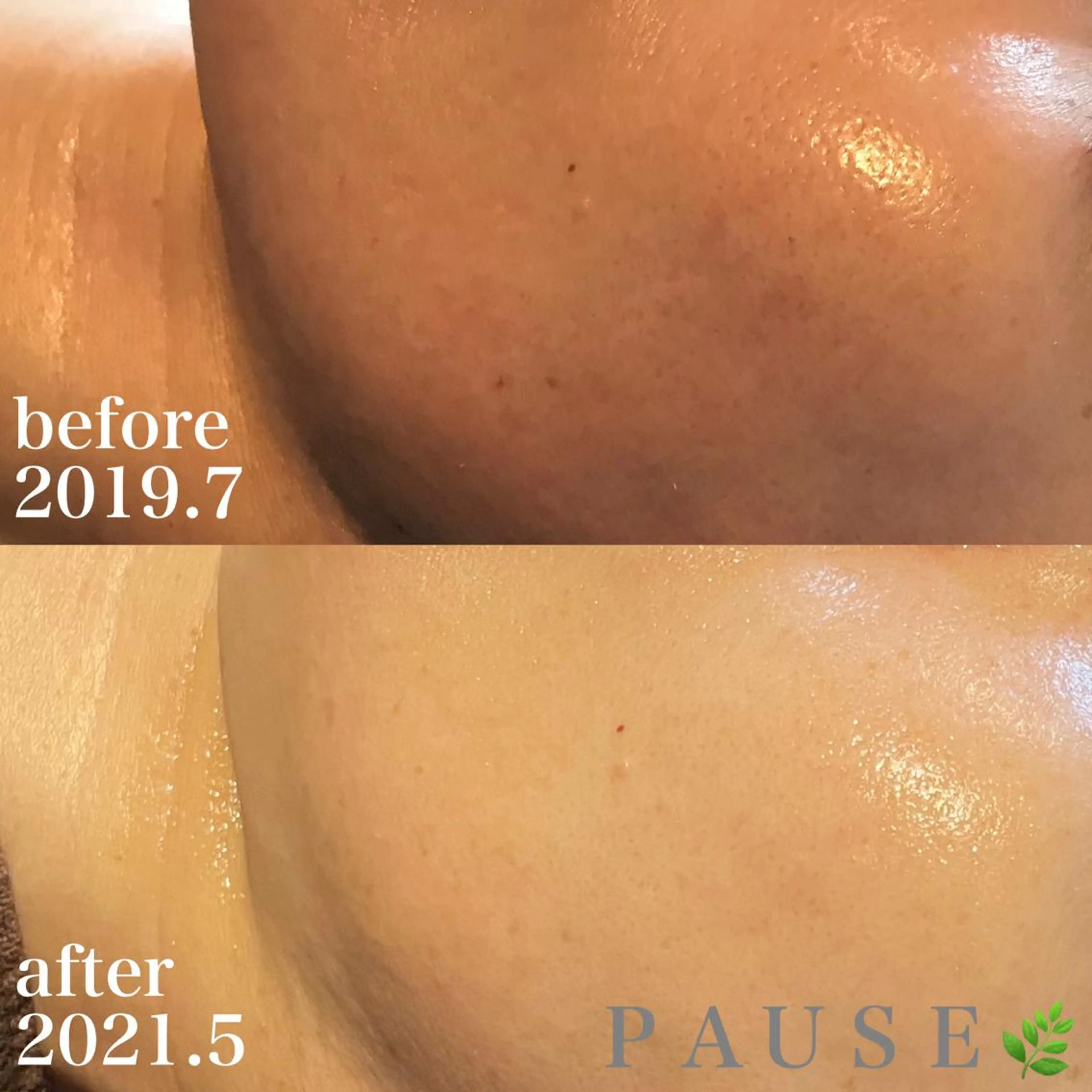 エステ リラク 浜野 恵美のエステ・リラクイメージ