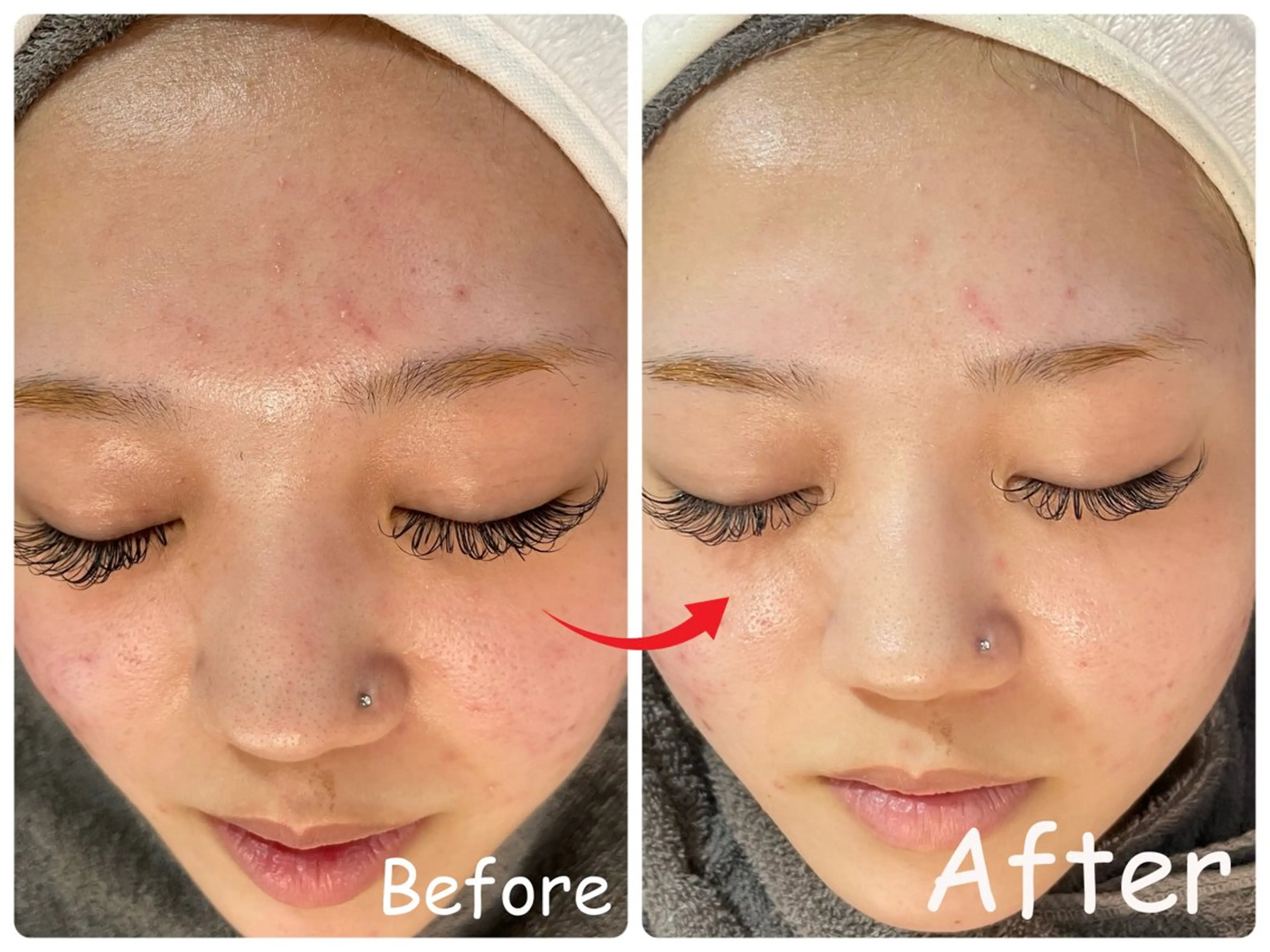 エステ リラク ele"ハーブ ピーリング 専門店のエステ・リラクイメージ