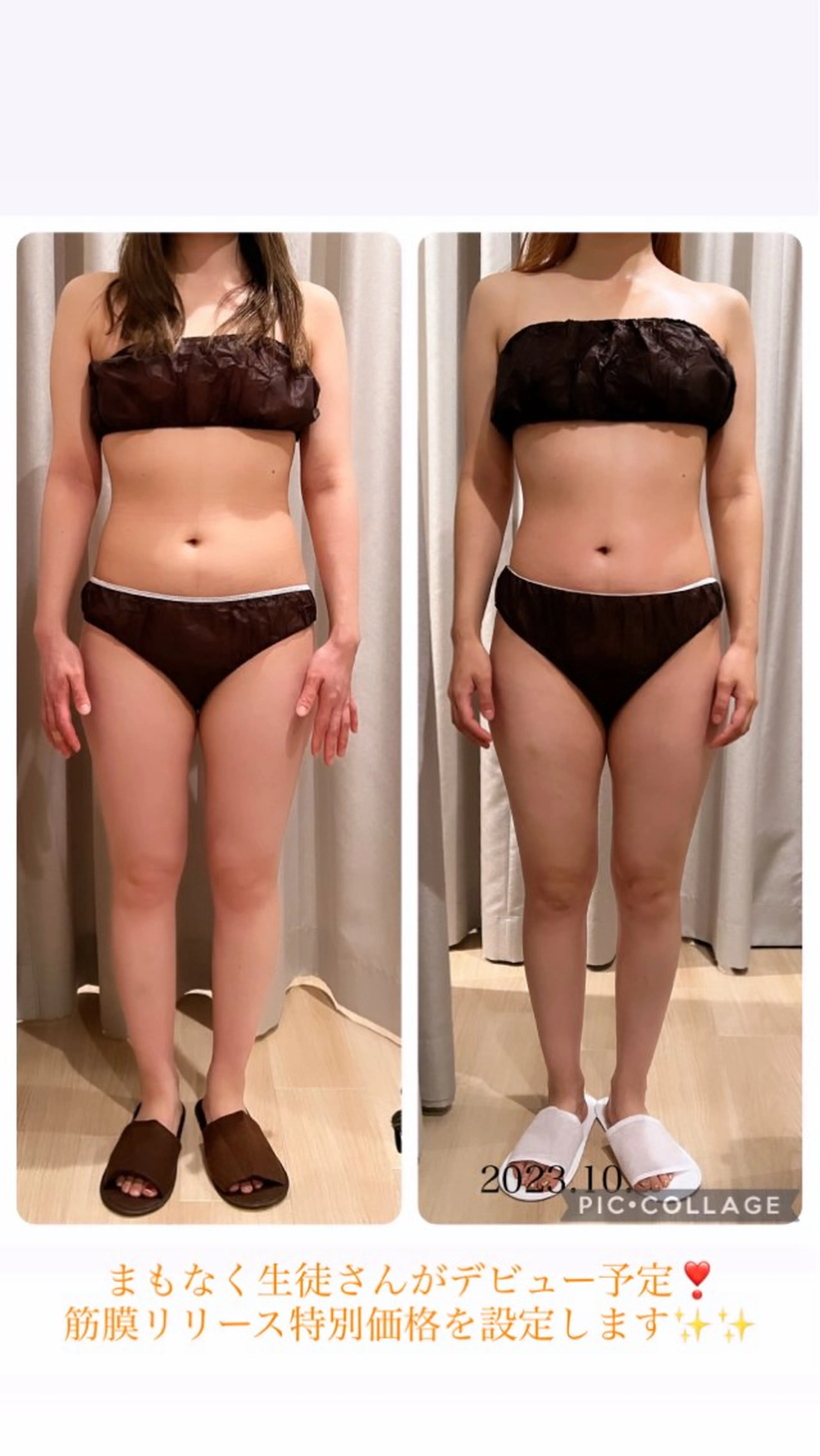 全身筋膜リリース.セルライトケアの写真