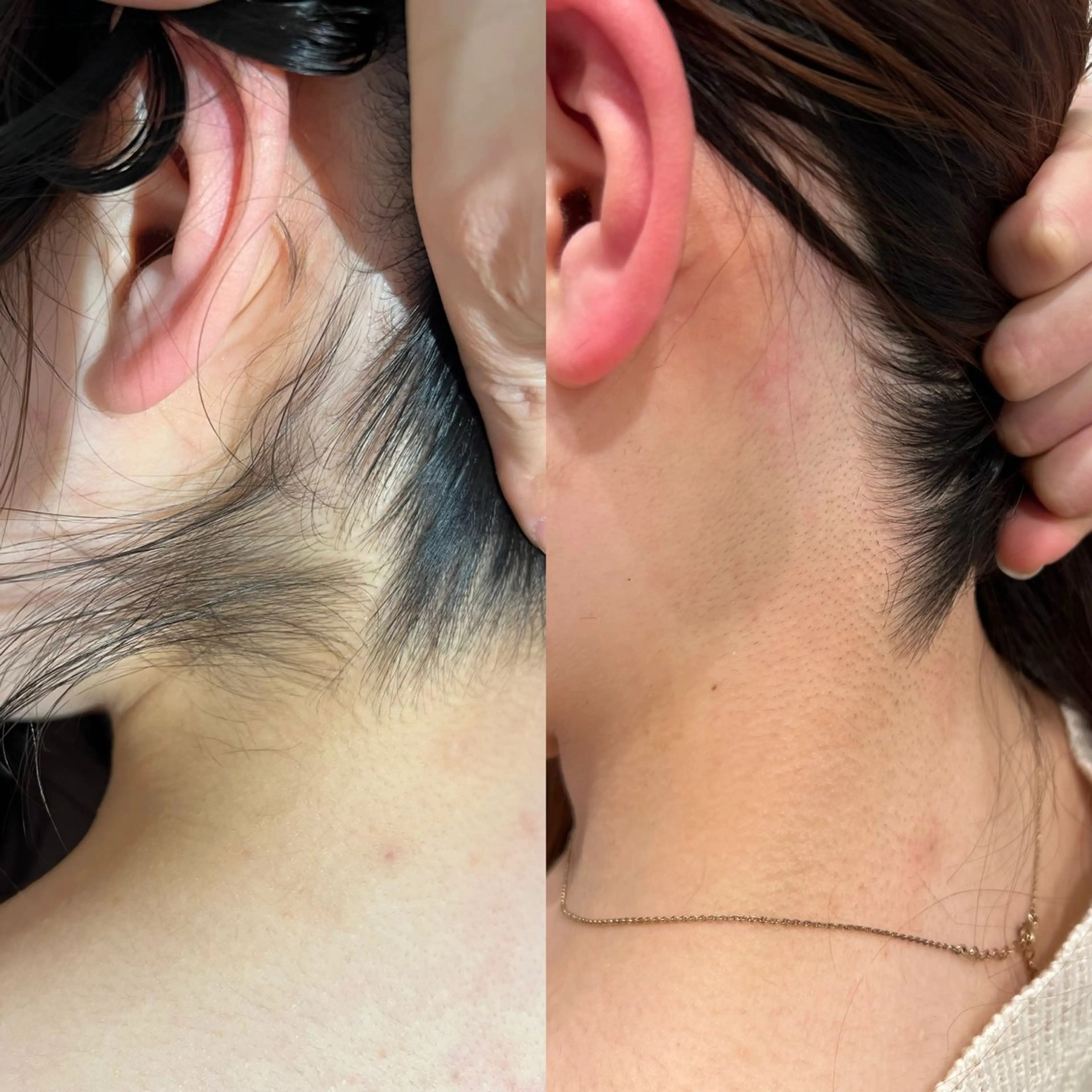 beautysalon FourV所属・名駅🌼無痛美肌脱毛 /フェイシャルのエステ・リラクイメージ