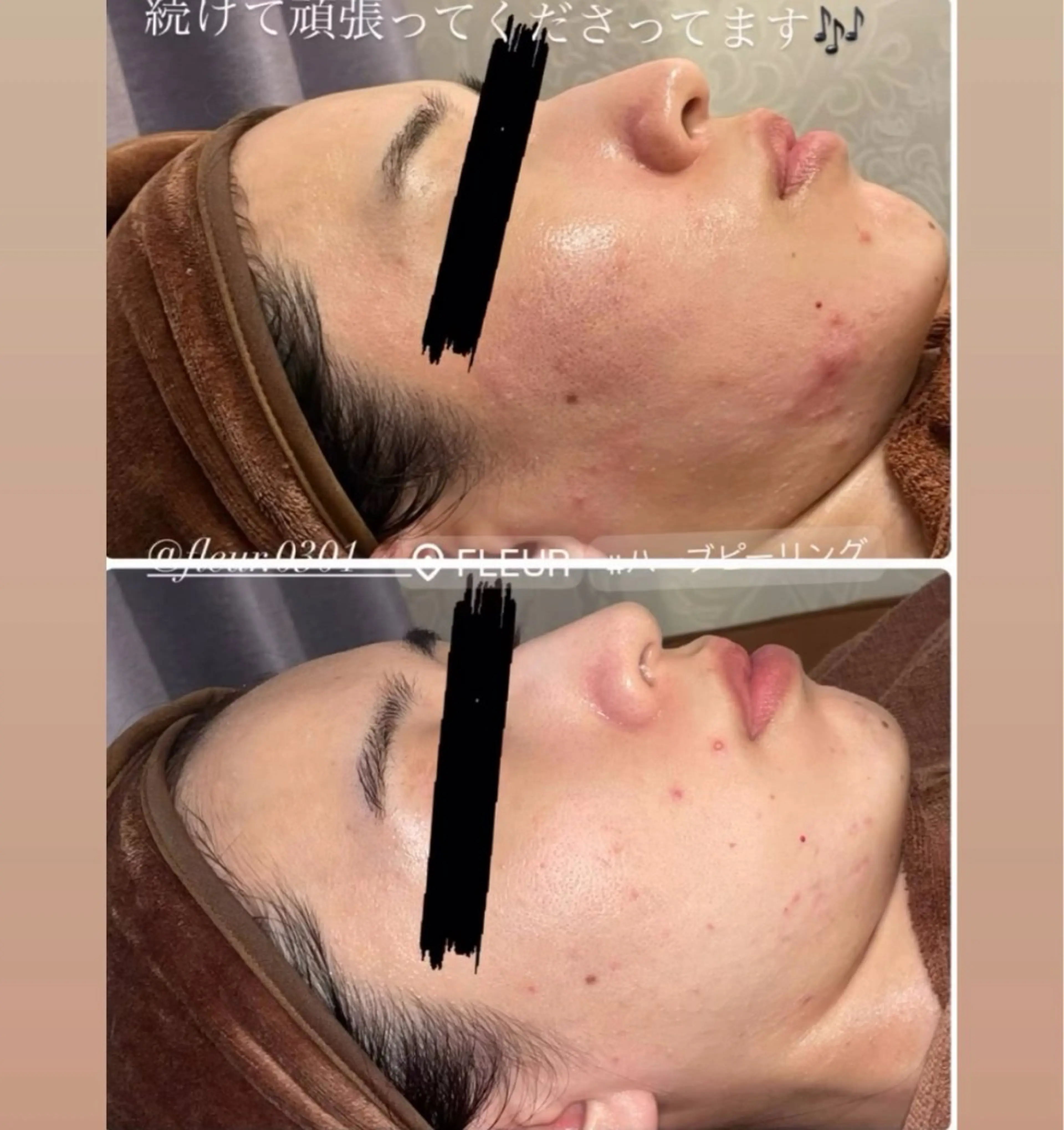 FLEUR 2号店のエステ・リラクイメージ