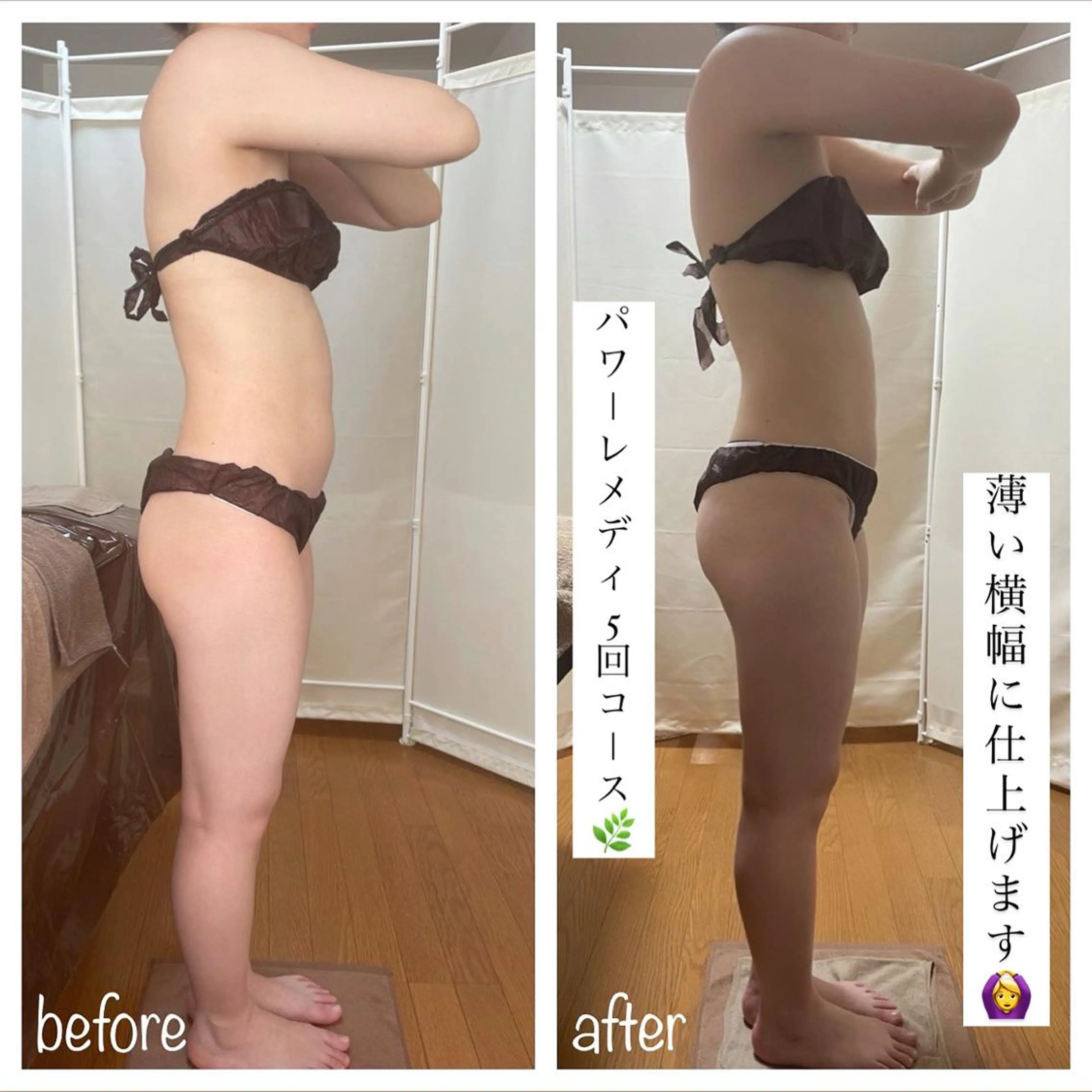 《本気痩せ×疲労改善 》  BILOOPのエステ・リラクイメージ