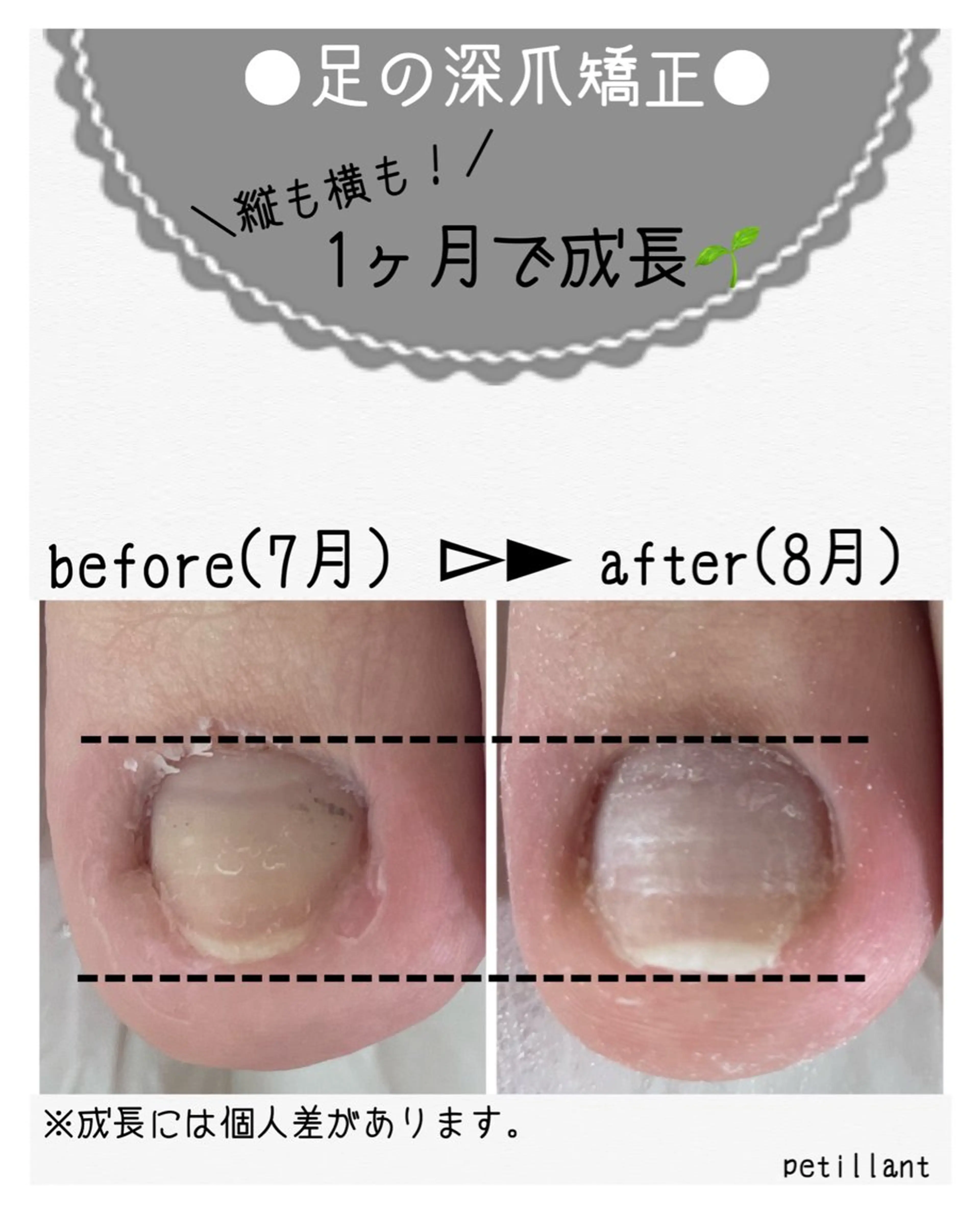ネイル 長さ出し フットネイル ジェルネイル nail salon petillantのネイルデザイン