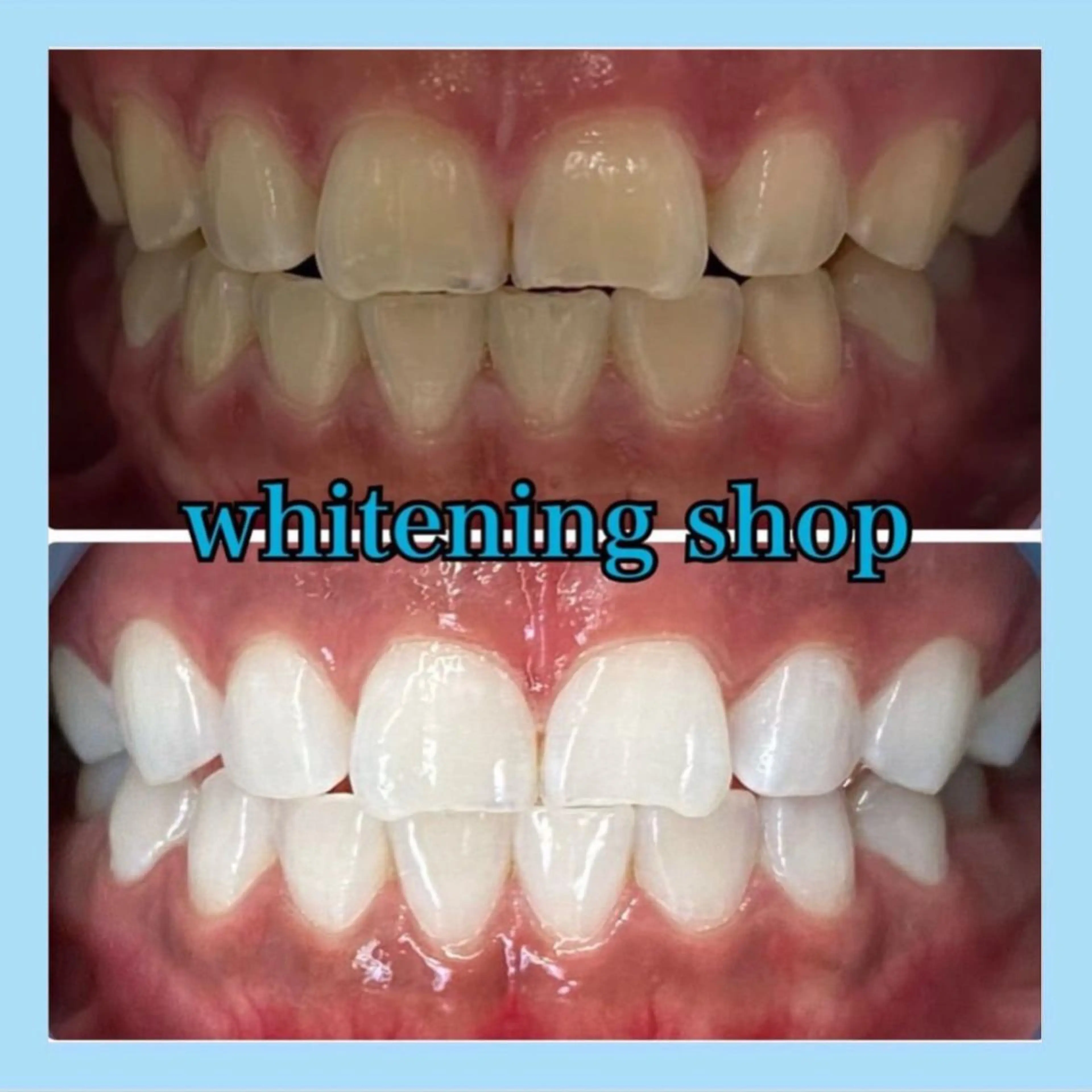 ホワイトニング ショップ千葉店のその他イメージ