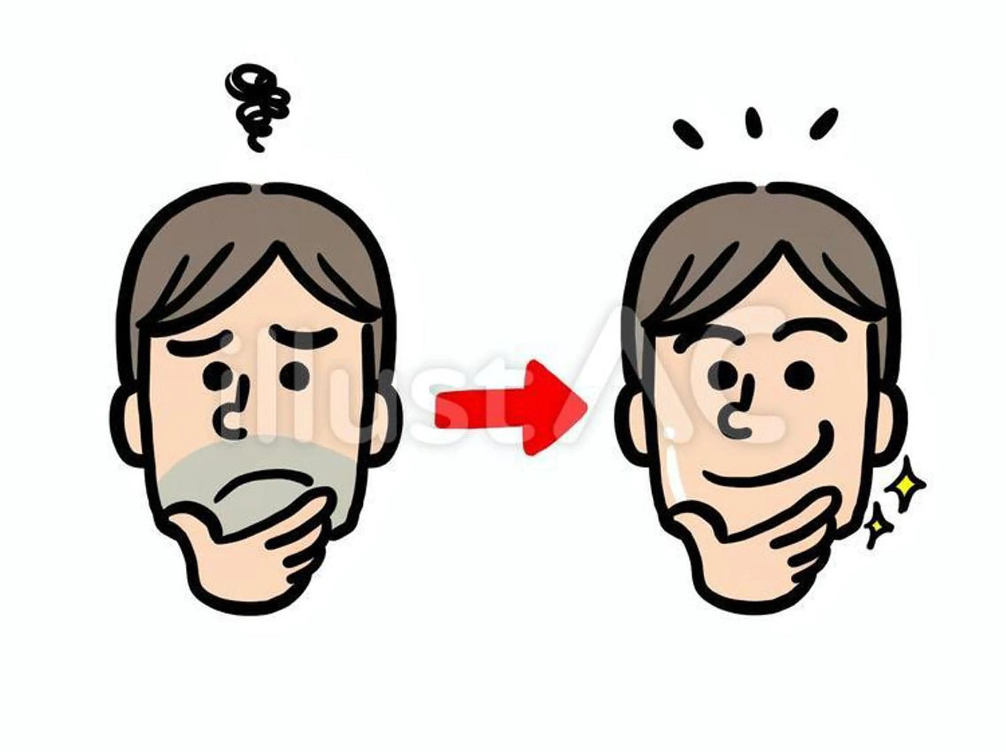 メンズひげ脱毛1回3900円(鼻下から顎ラインまで)の写真