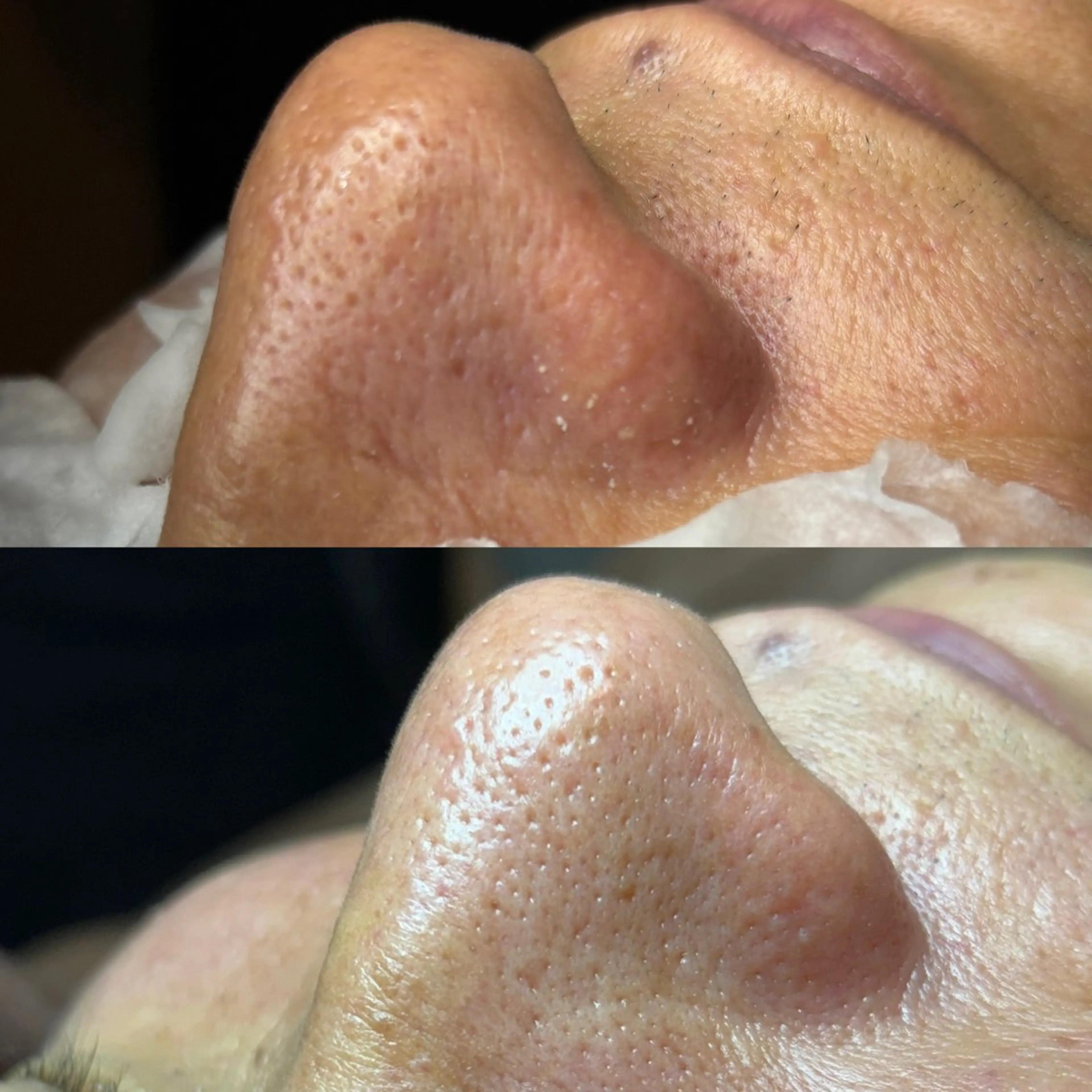 エステ リラク セルフエステエンリケ明石大久保店所属・夕希 毛穴と脱毛特化サロンのエステ・リラクイメージ