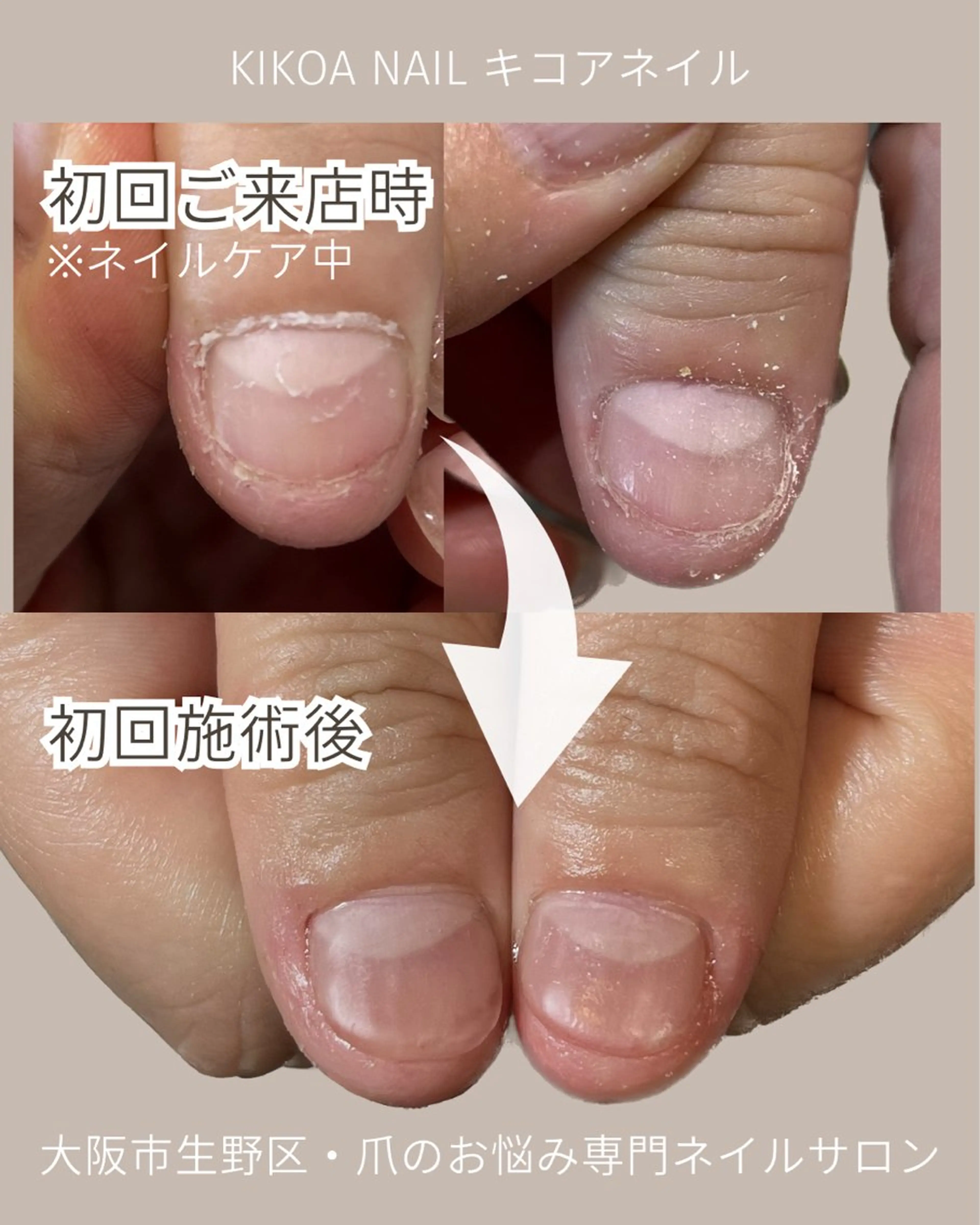 ネイル KIKOA NAIL キコアネイルのネイルデザイン