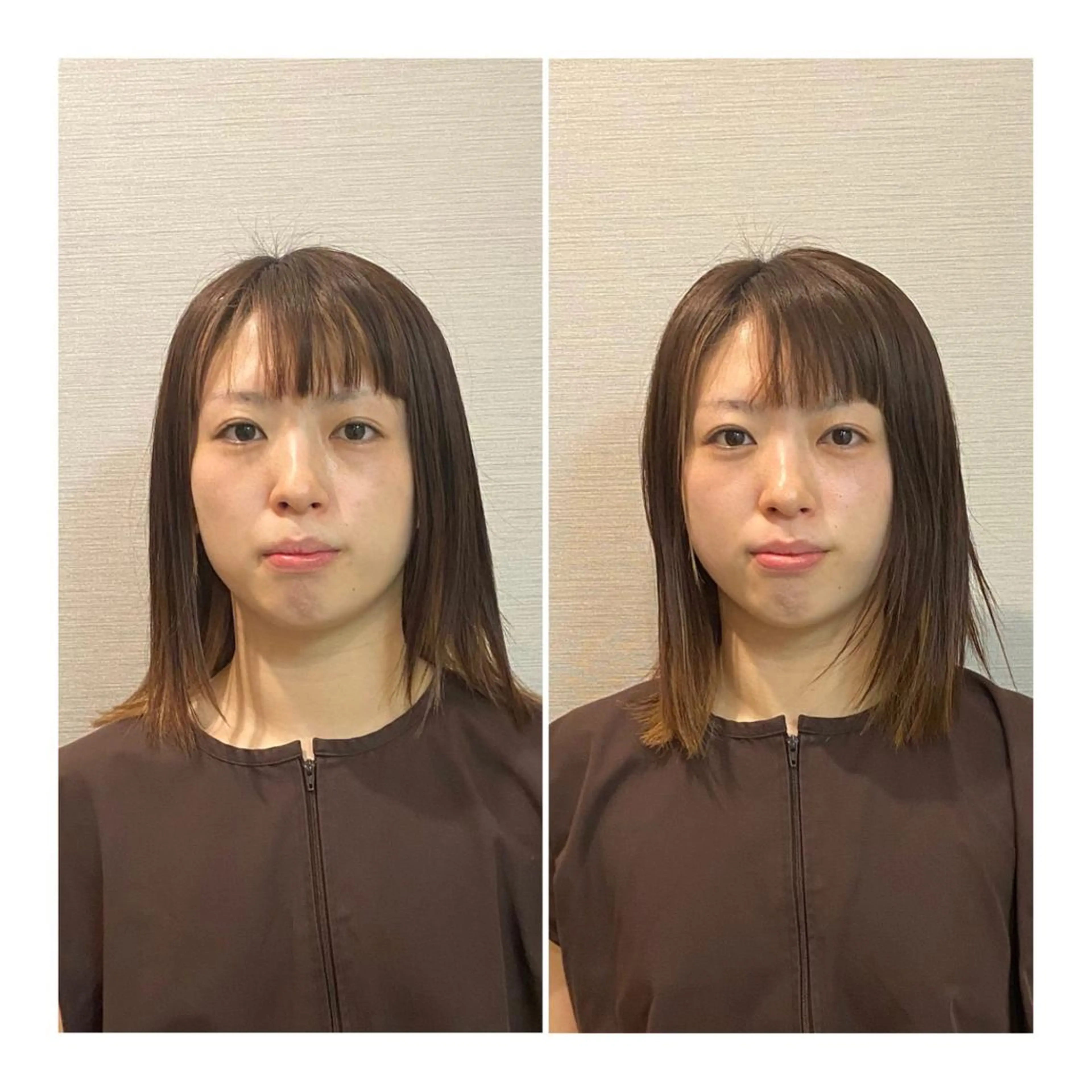 その他 即小顔♥️美容鍼× ハーブピーリングのその他イメージ