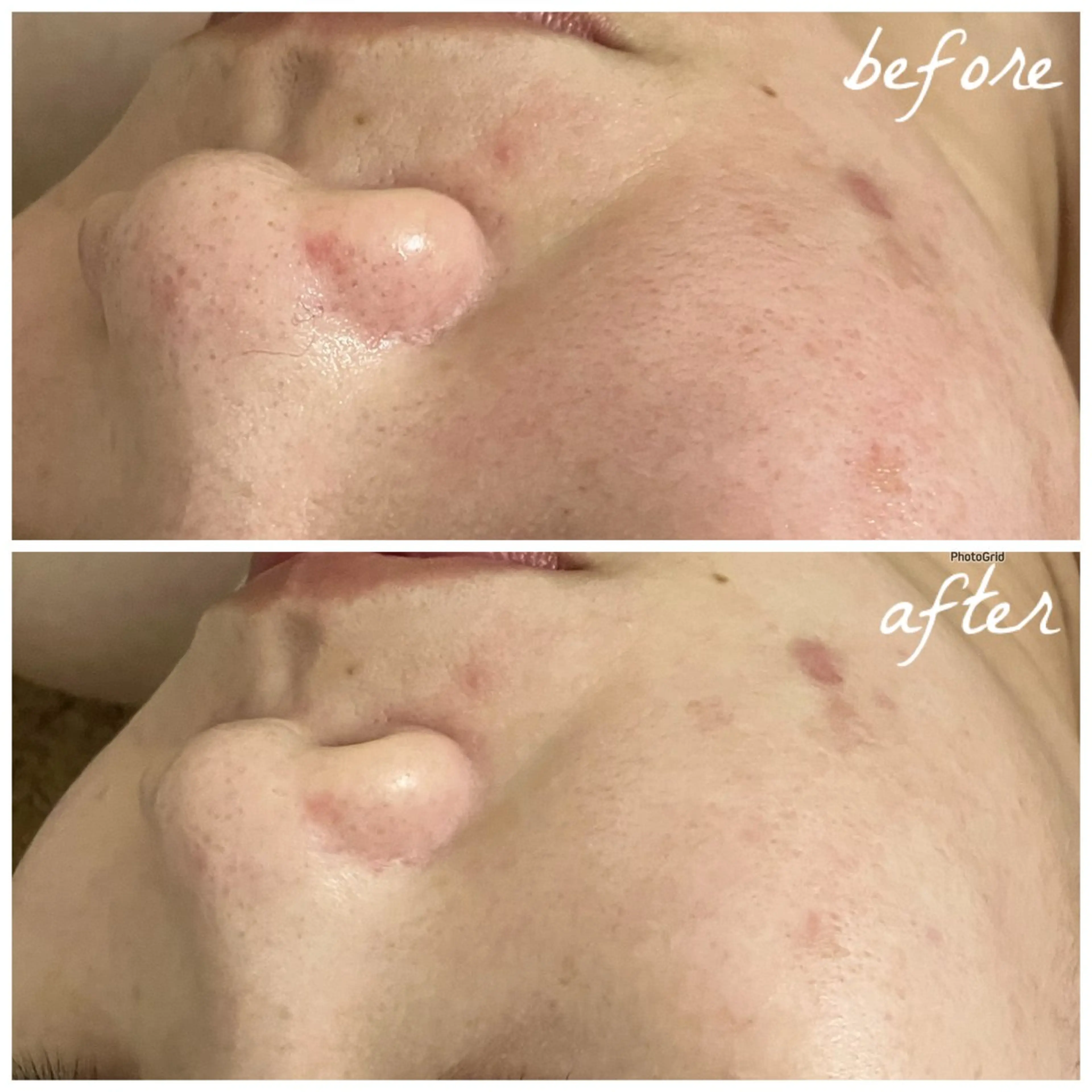 メンズ エステ メナード岐阜市茜部 杉浦のエステ・リラクイメージ