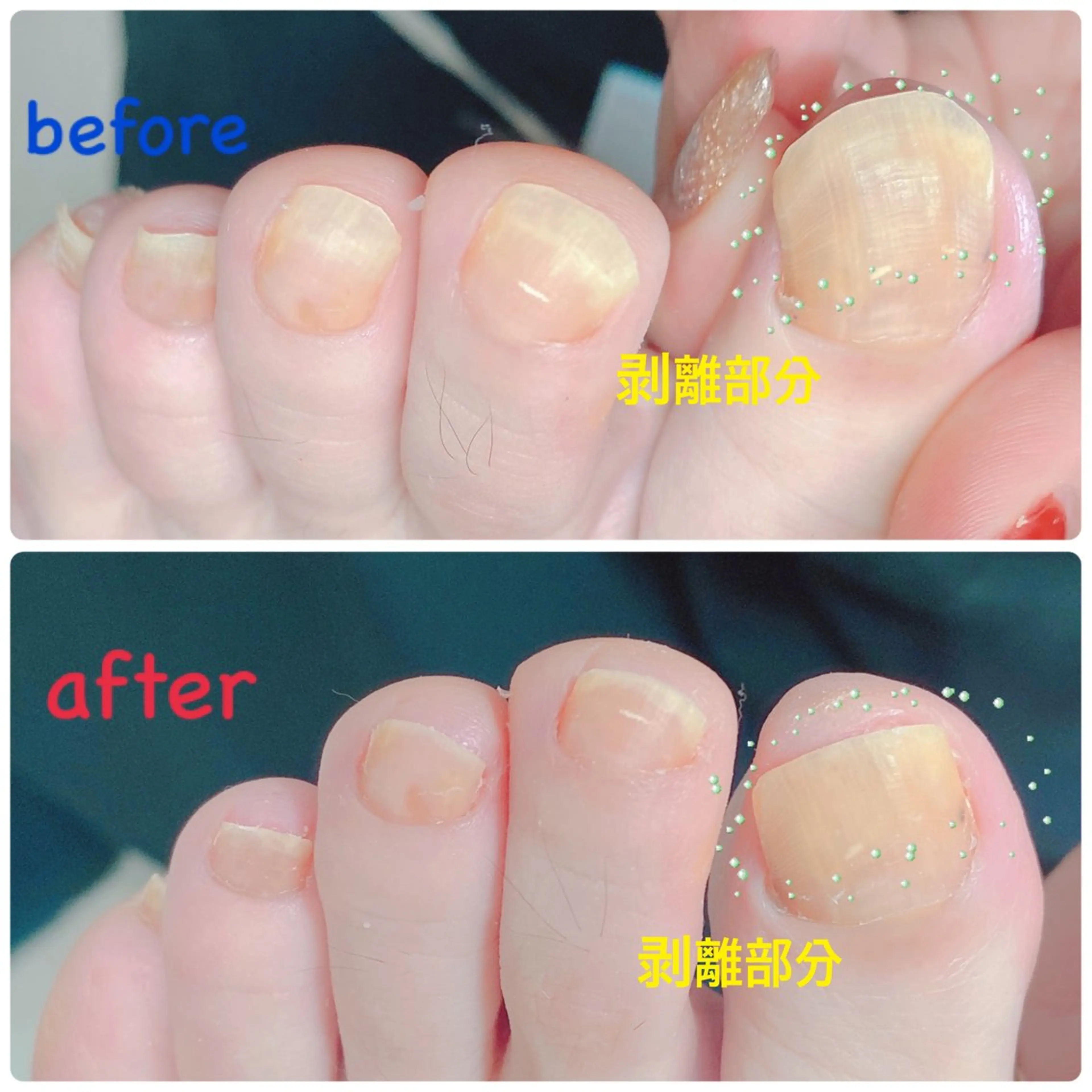 ネイル その他(ネイル) 柴崎 美幸のネイルデザイン