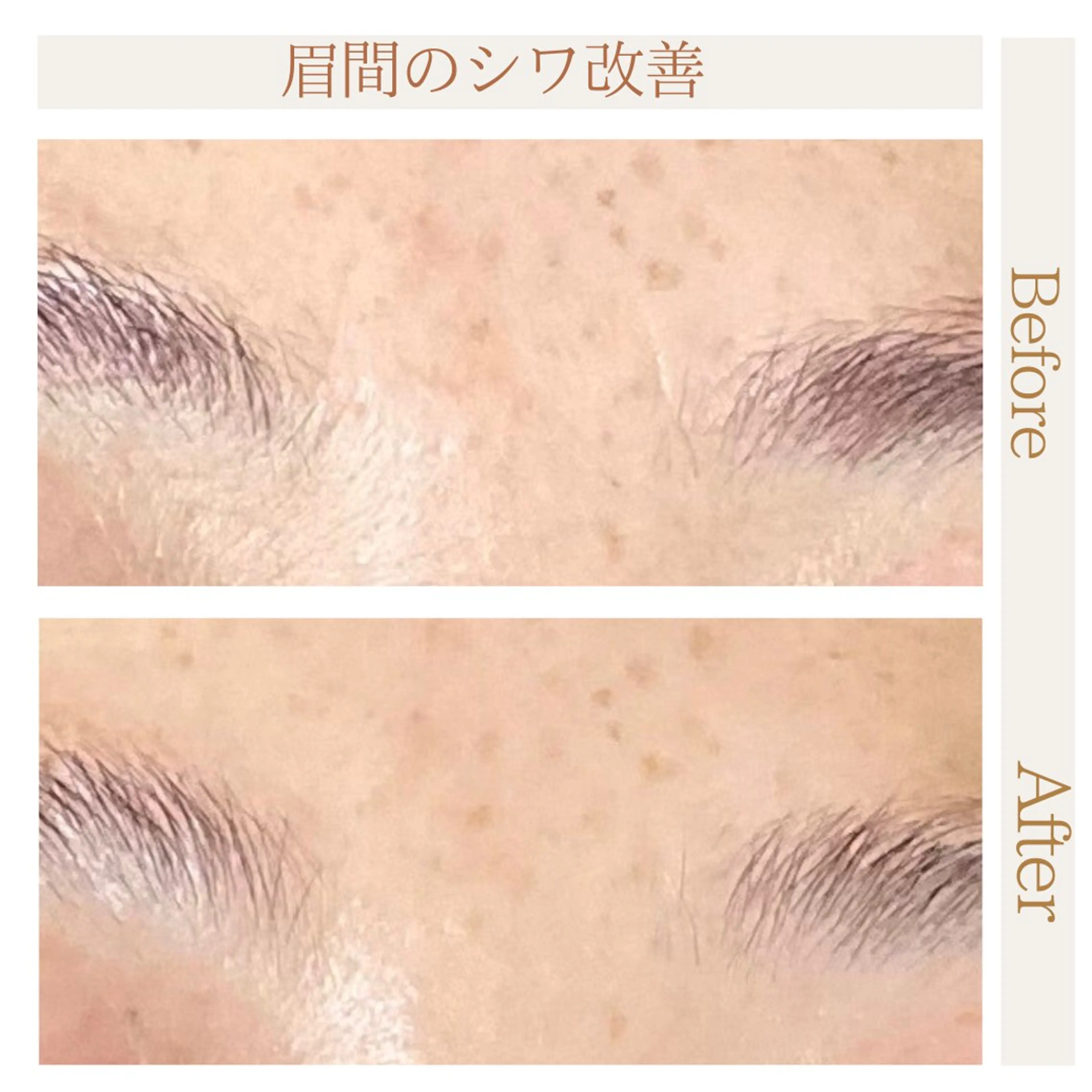 ハーブピーリング・ Mikaのメニューのエステ・リラクイメージ