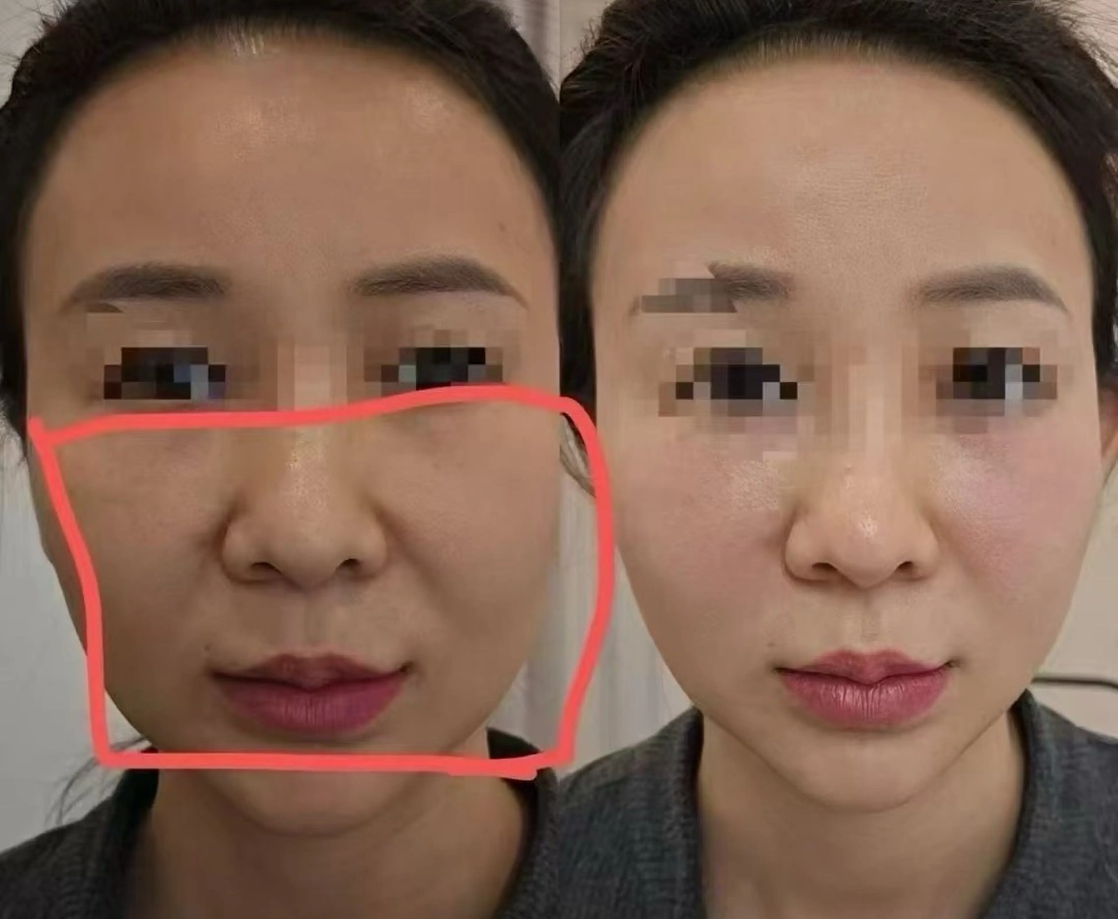 ネイル aliaハーブ水光店 エステティシャン募集のエステ・リラクイメージ