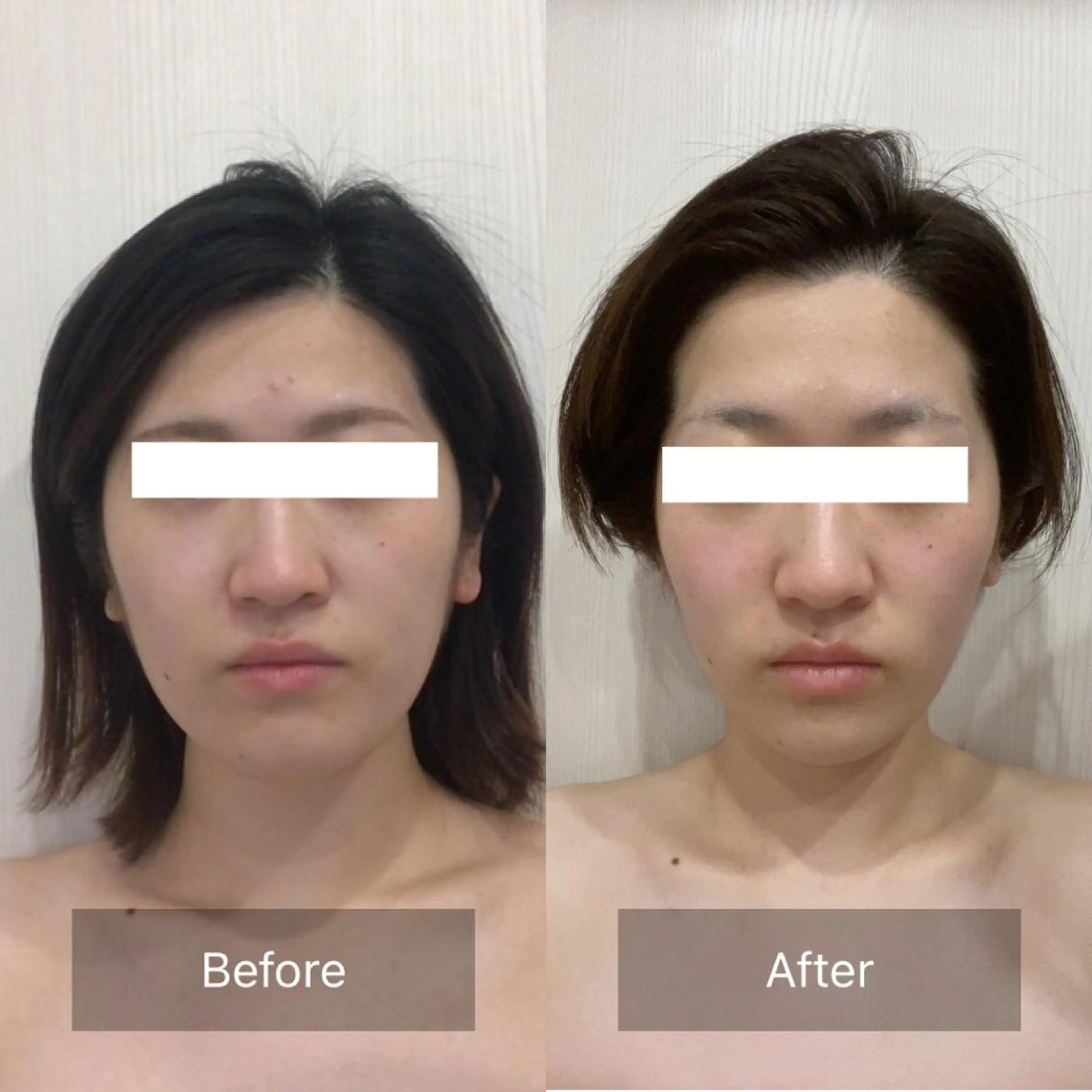 【即小顔×たるみゼロへ♪】脳洗浄®︎小顔ヘッドスパ　デコルテ付き100分の写真