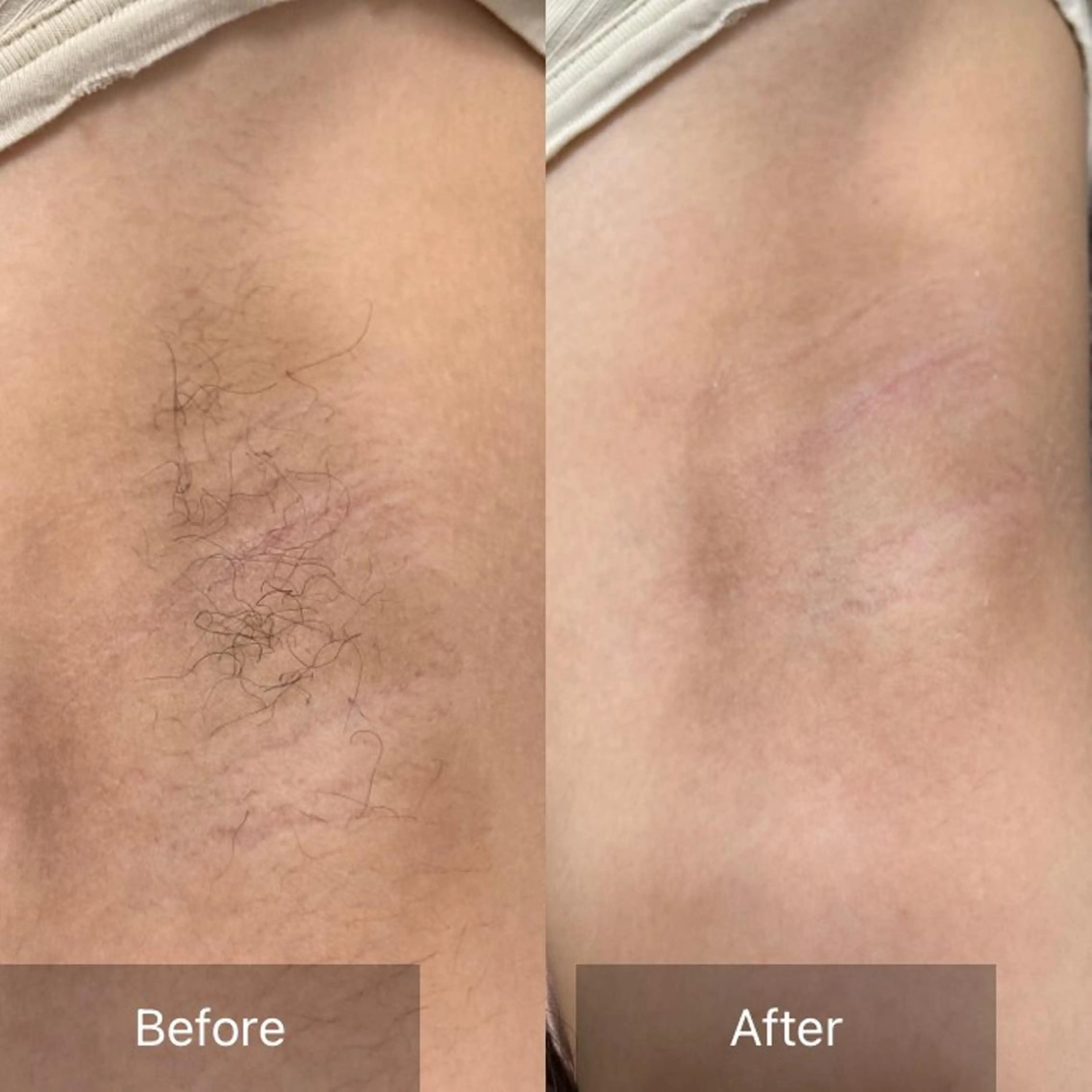 脱毛 産毛専門店 Bittoのエステ・リラクイメージ