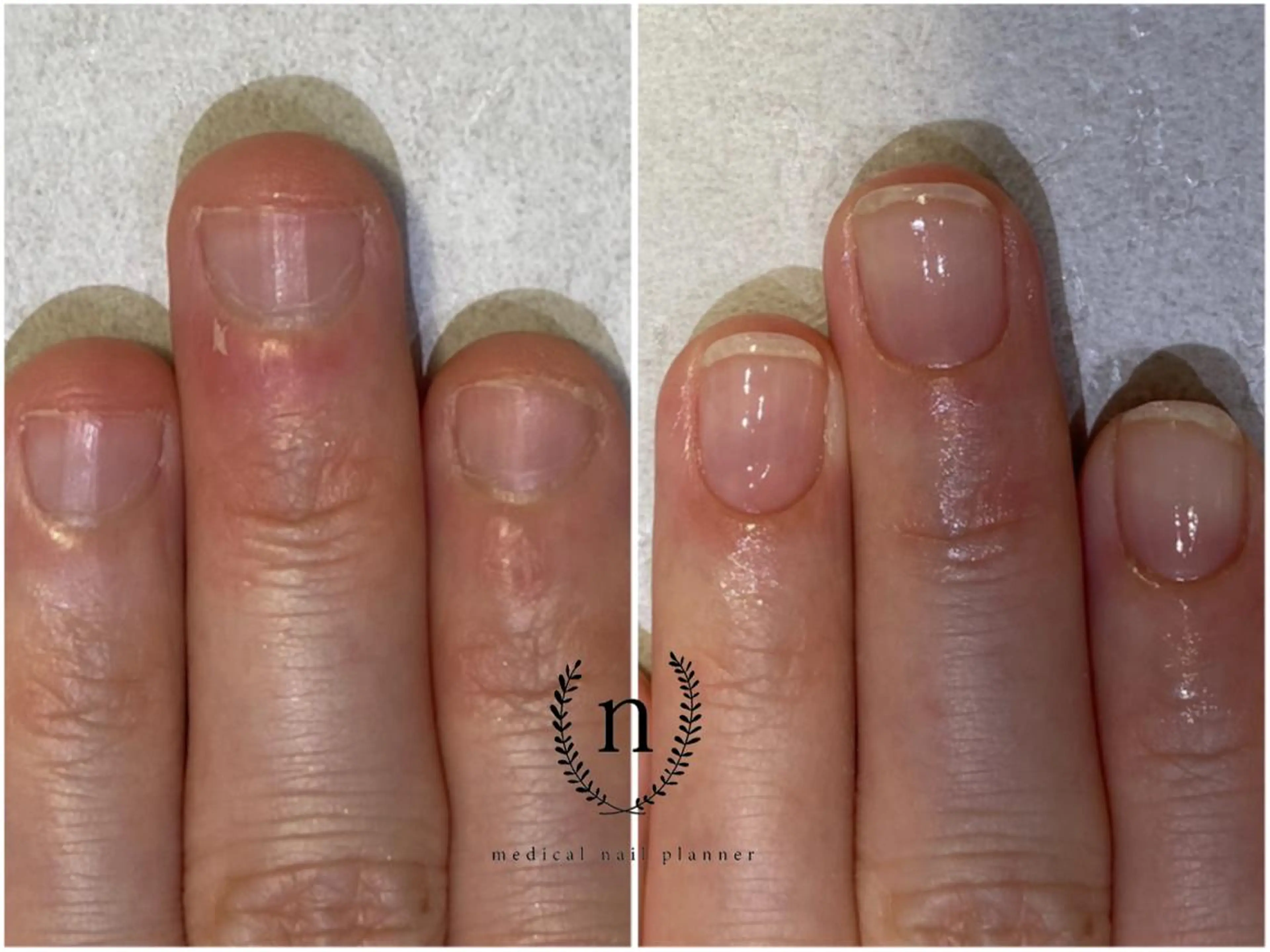 ネイル Rio 𓍼のネイルデザイン