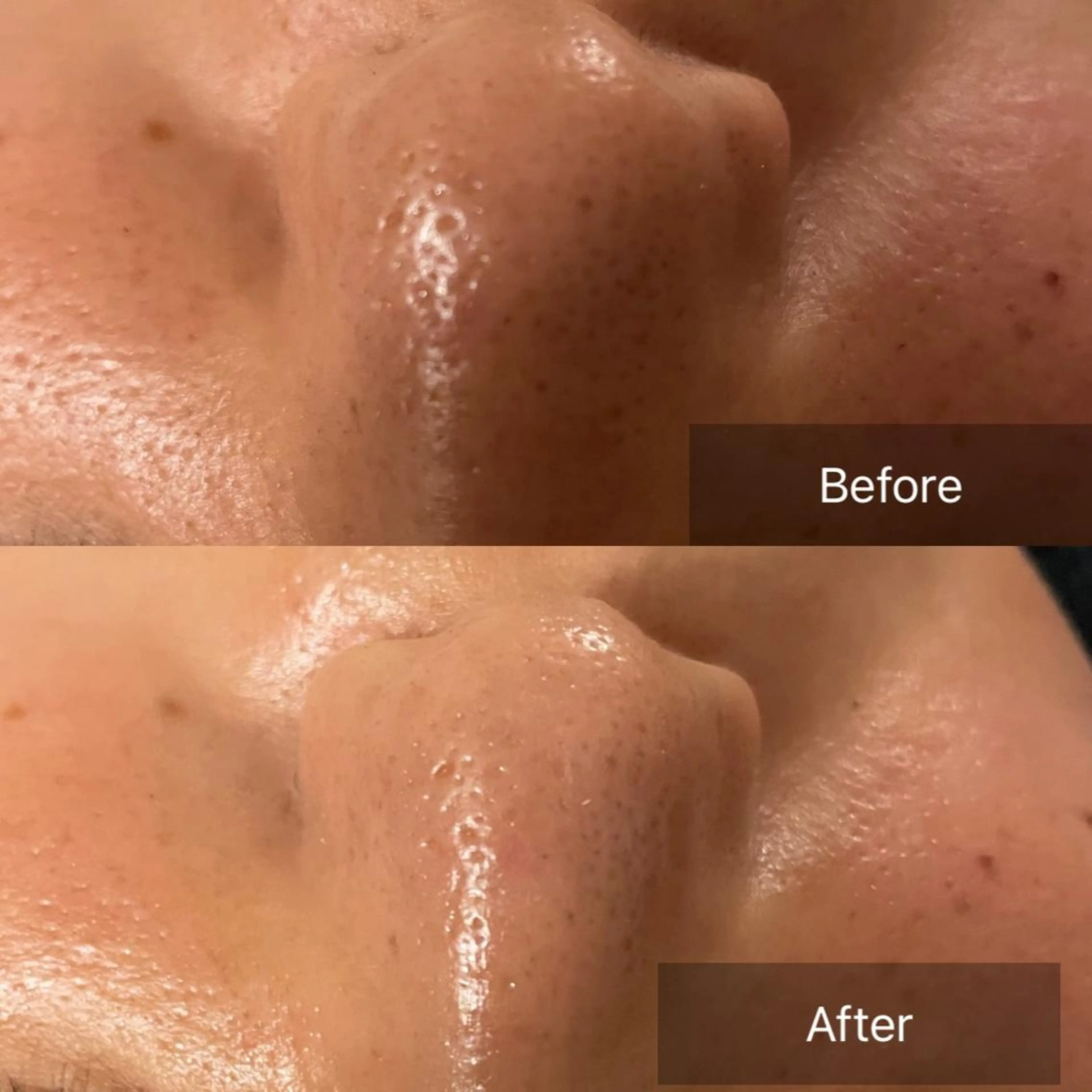 美楽鍼 びらくしんのその他イメージ