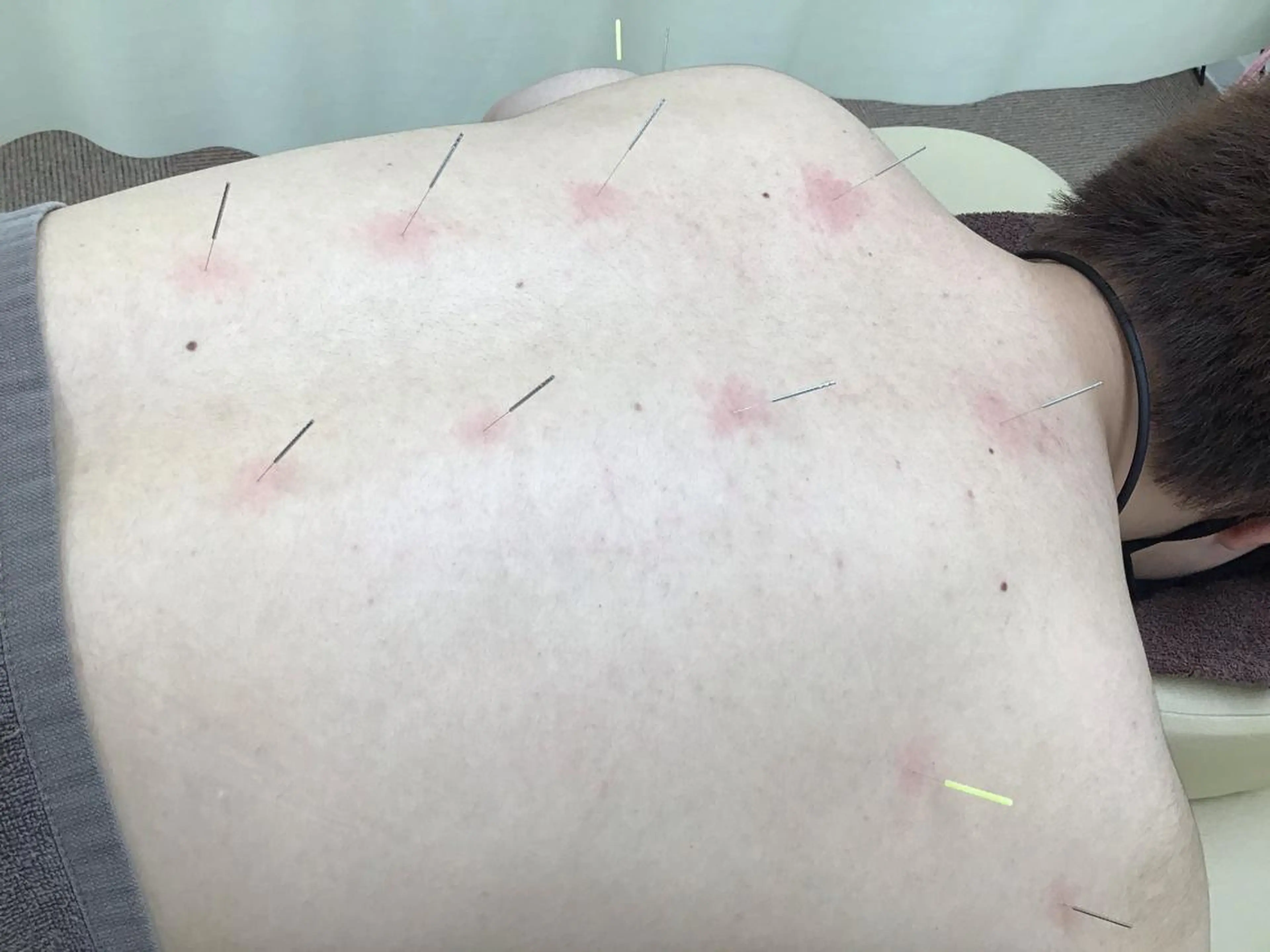 エステ リラク まごころ鍼灸整骨院所属・まごころ鍼灸整骨院 京王堀之内院のエステ・リラクイメージ