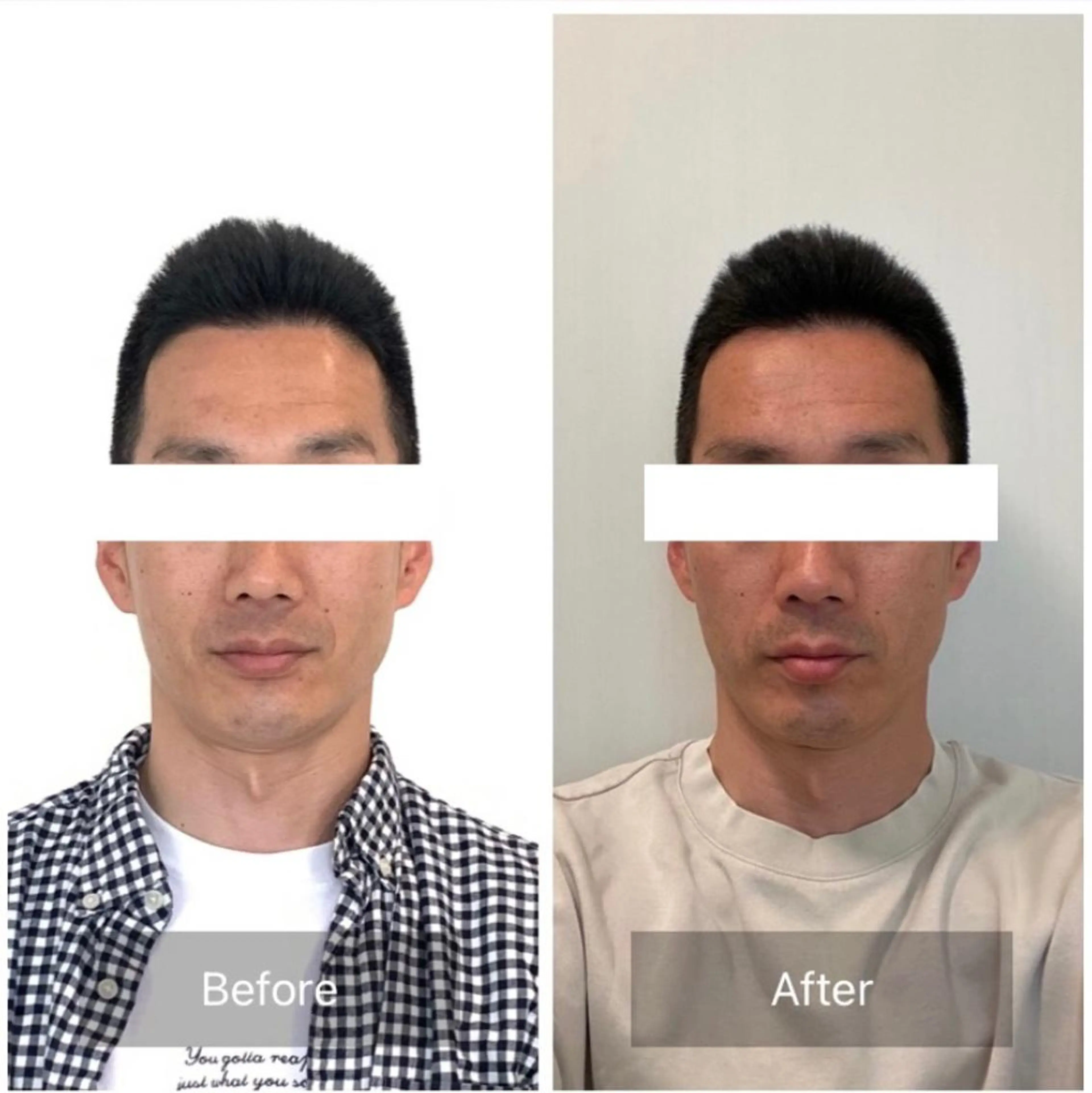 エステ リラク 小顔と ヘッドスパのお店のエステ・リラクイメージ