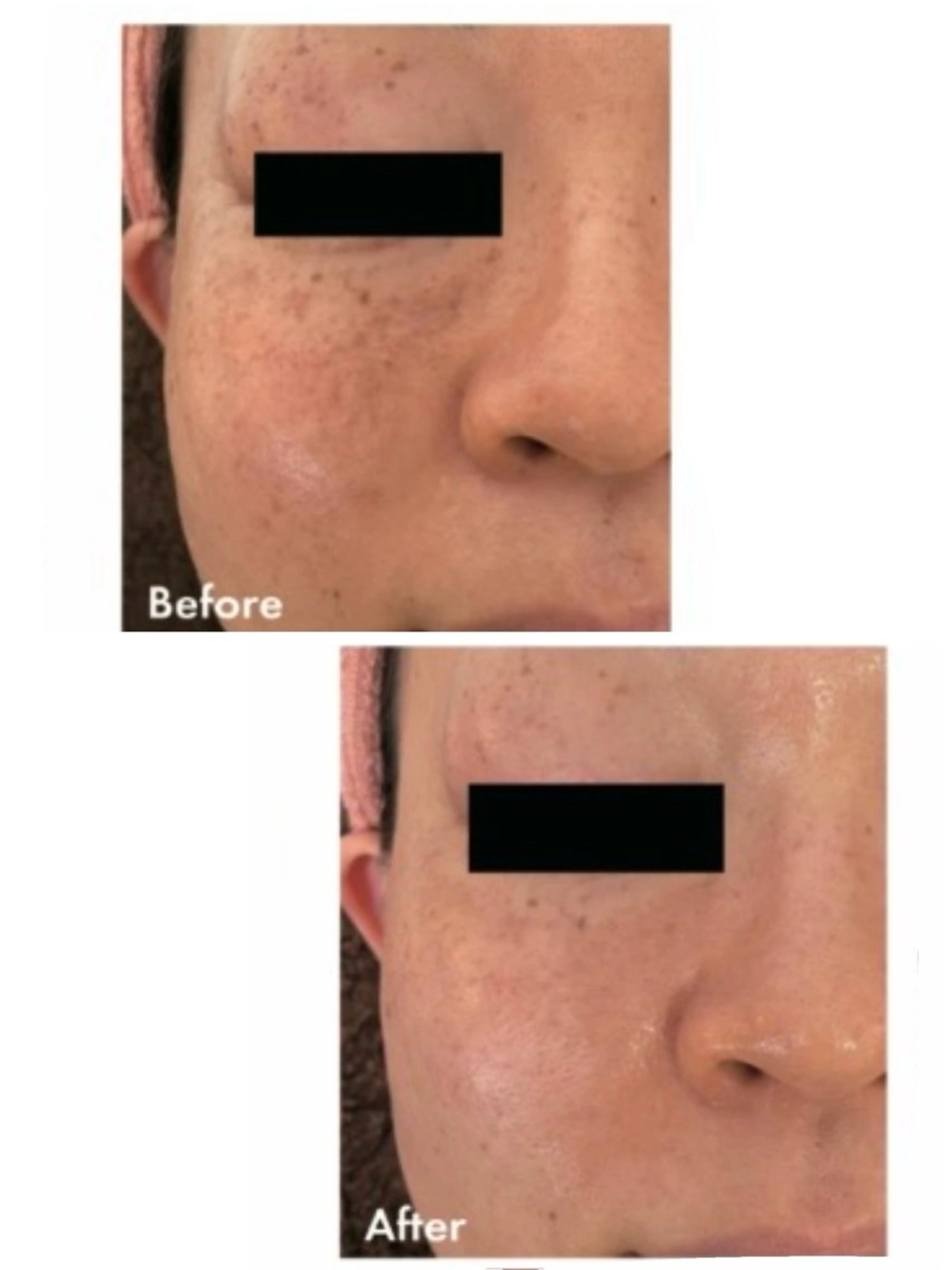 エステ private salon ponoのマツエク・マツパデザイン