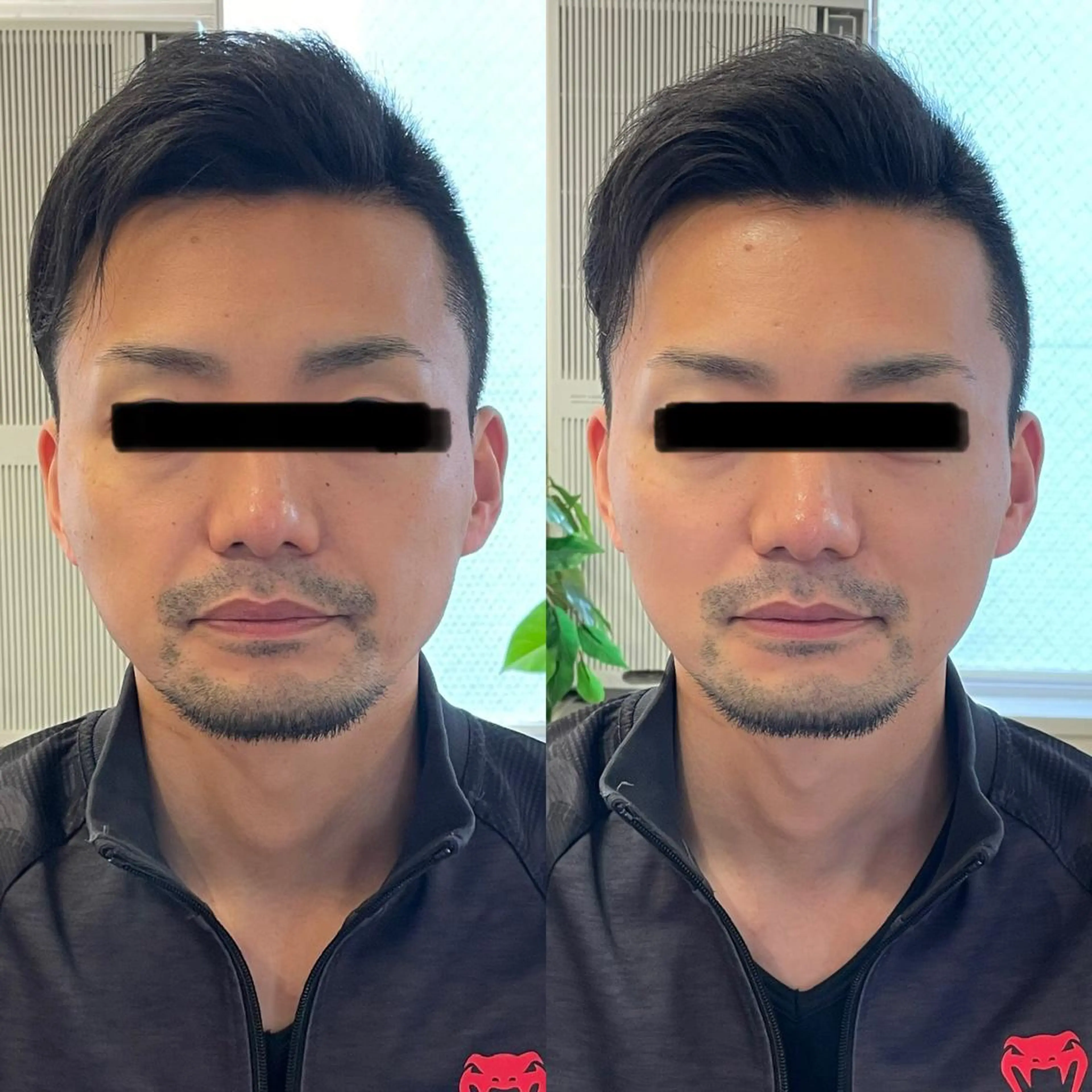 その他 つばさ所属・マッツンの 鍼のその他イメージ