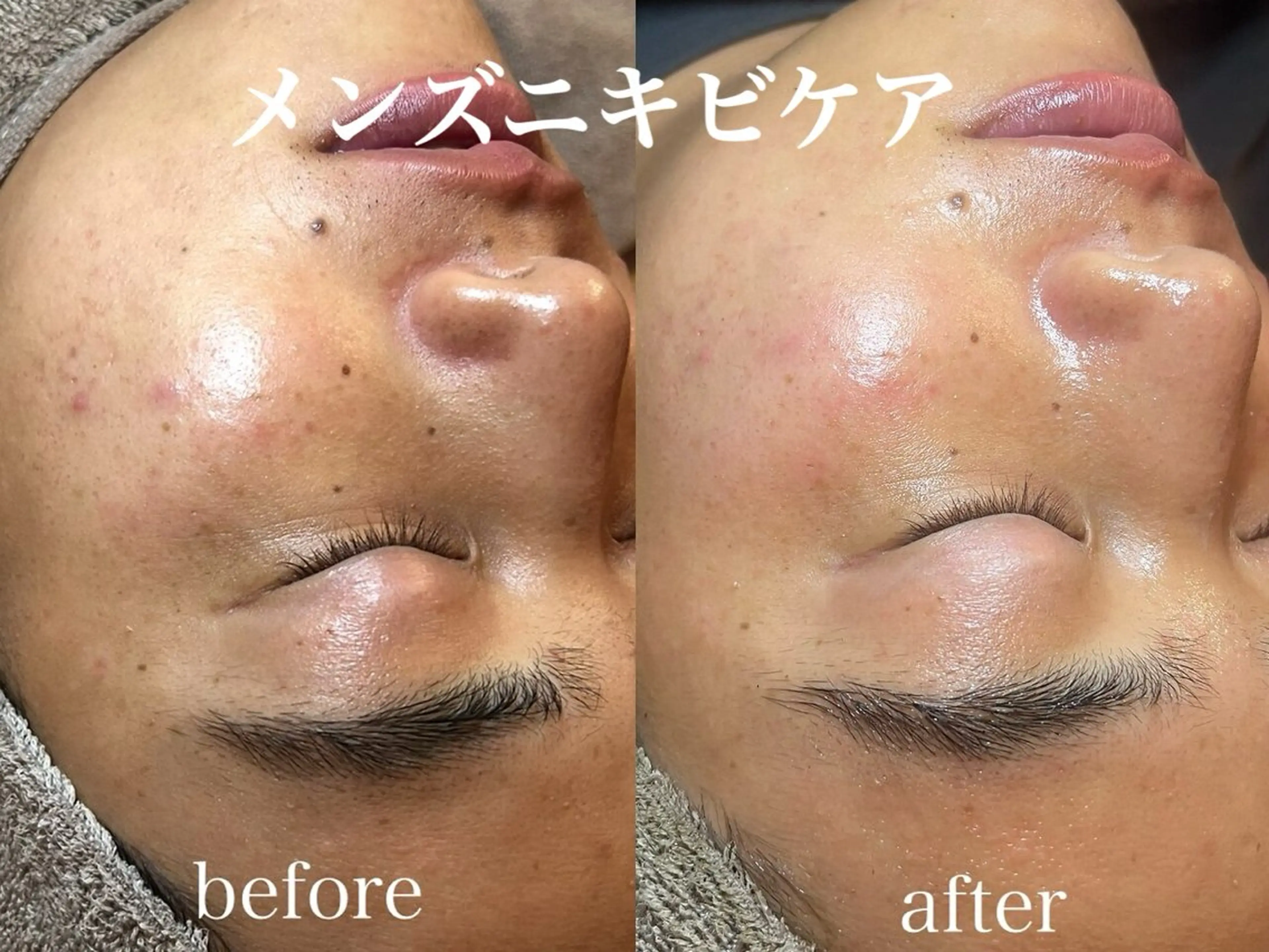 肌管理サロン neoriiのその他イメージ