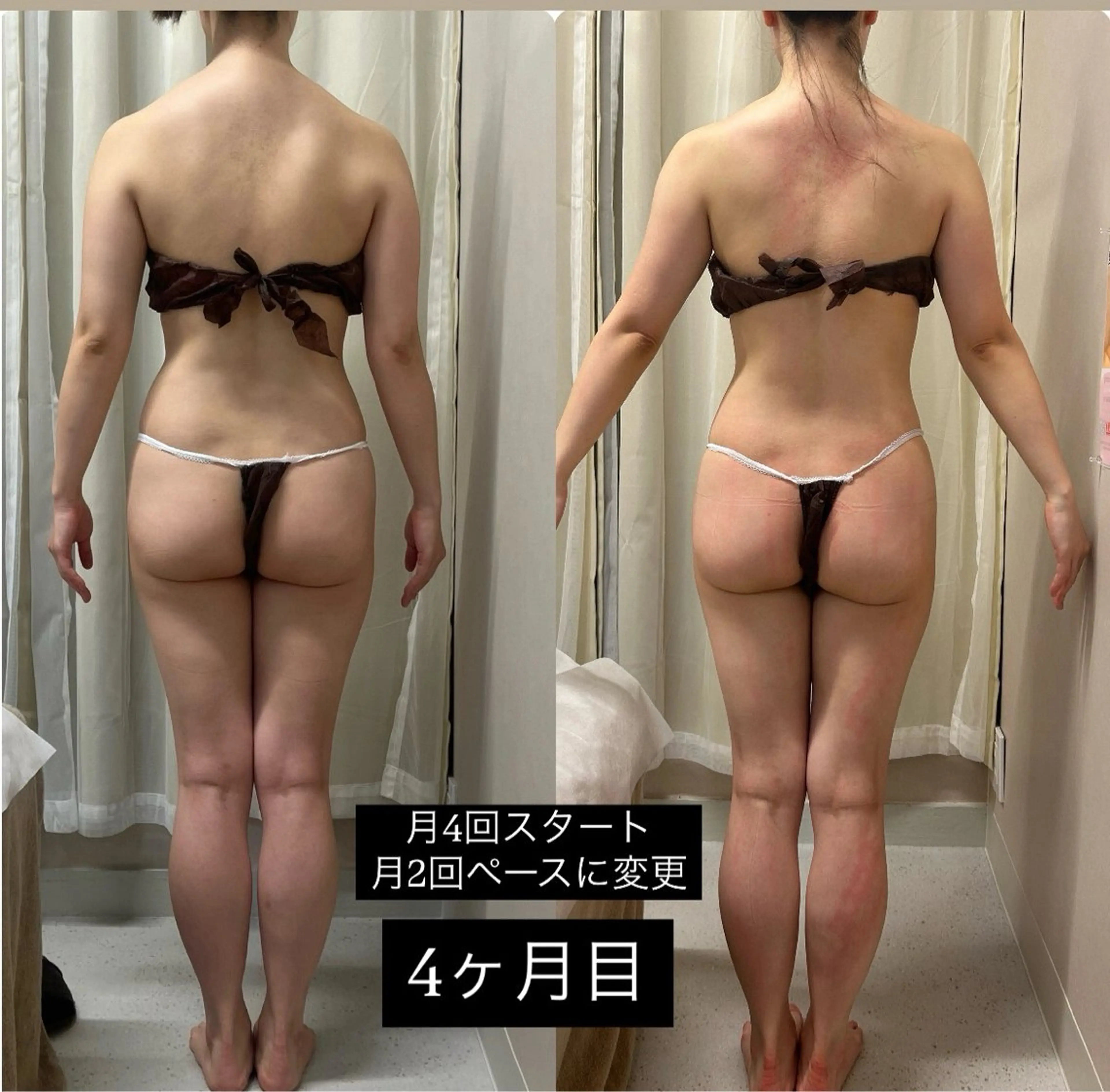 エステ Asmy 西梅田店所属・asmy 西梅田店のエステ・リラクイメージ