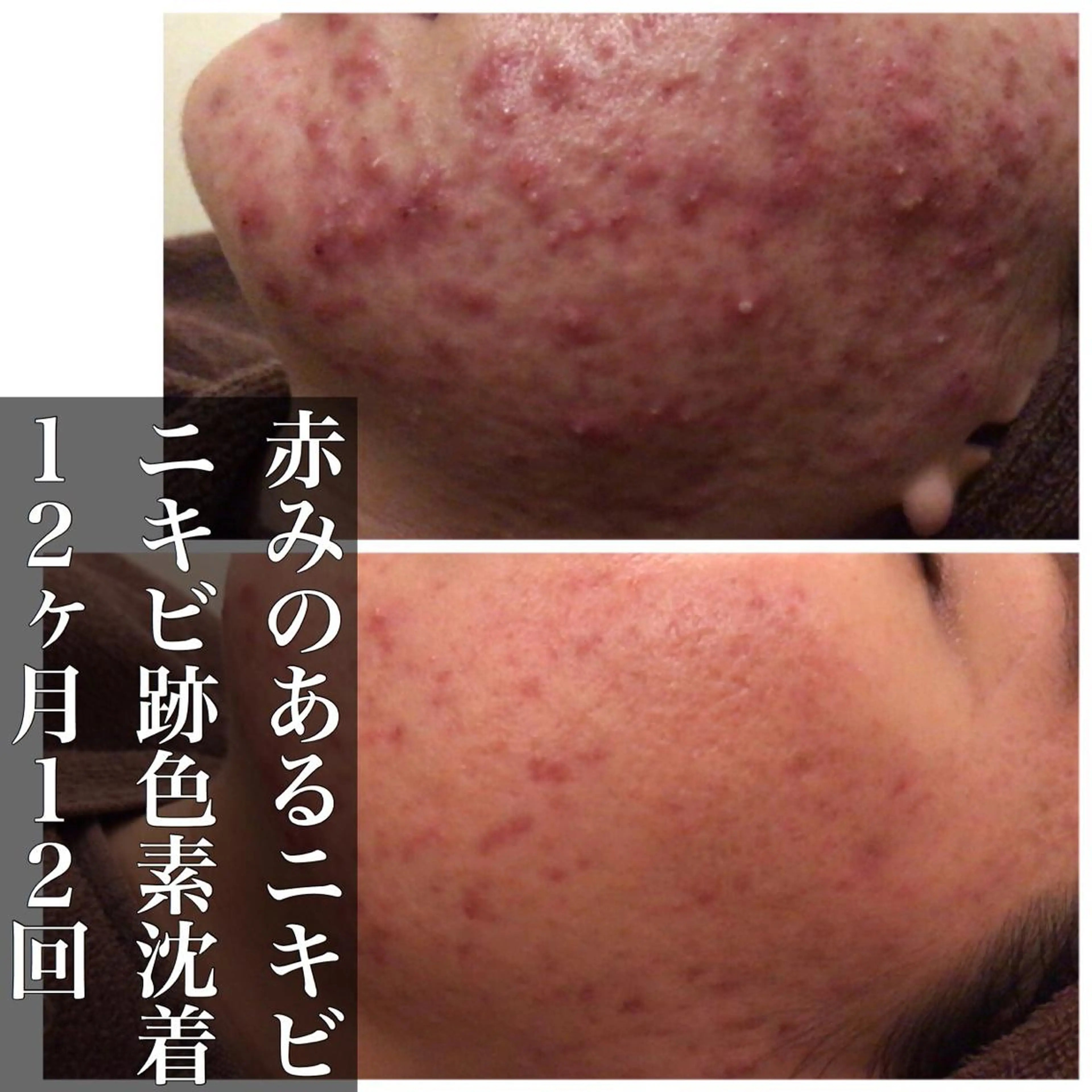 ミディアム カラー パーマ ヘアアレンジ メンズ キッズ ネイル マツエク・マツパ ニキビ・肌質改善専門 ♡人生が変わるサロンのエステ・リラクイメージ