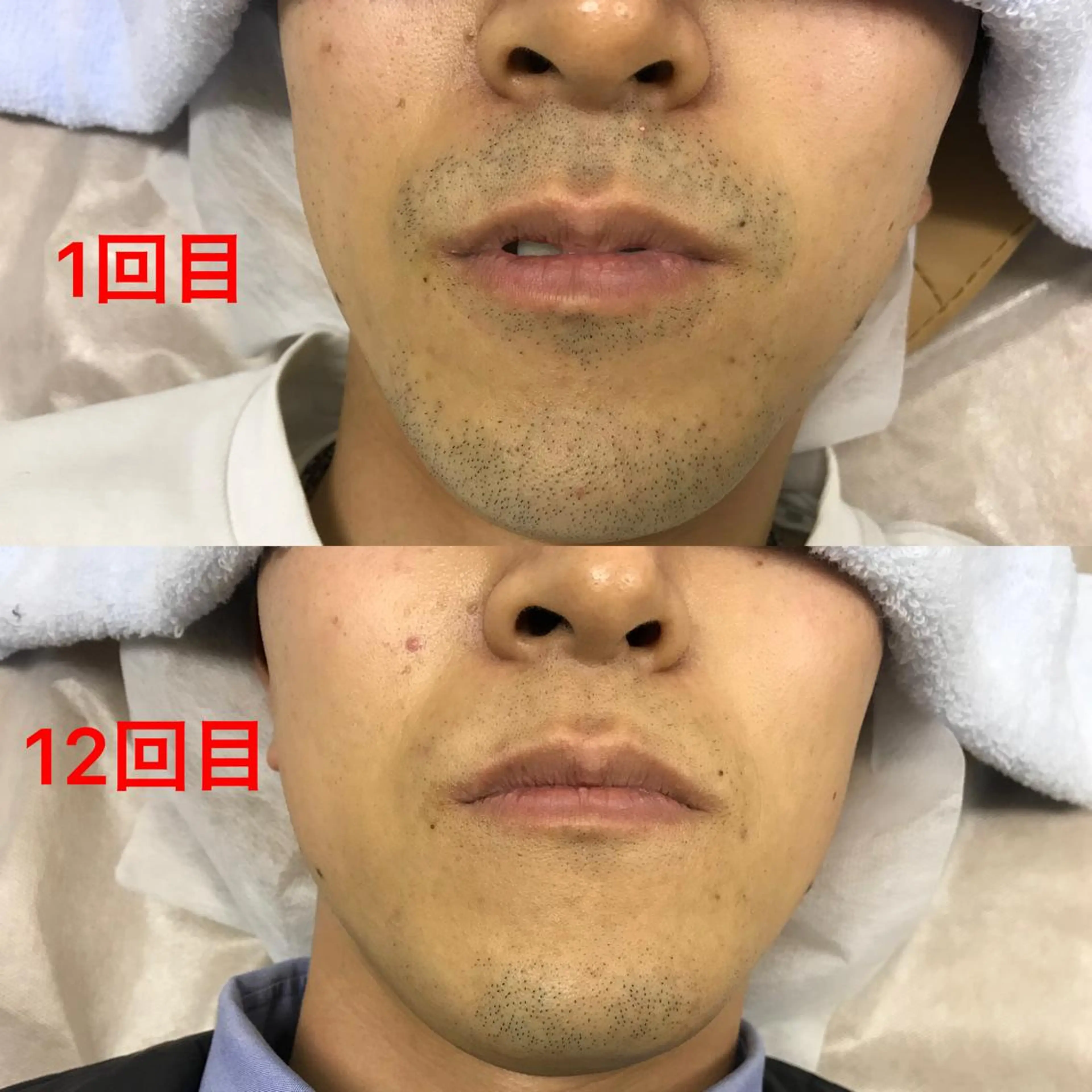 メンズ 脱毛 メンズ脱毛サロン ／金山昌弘のエステ・リラクイメージ