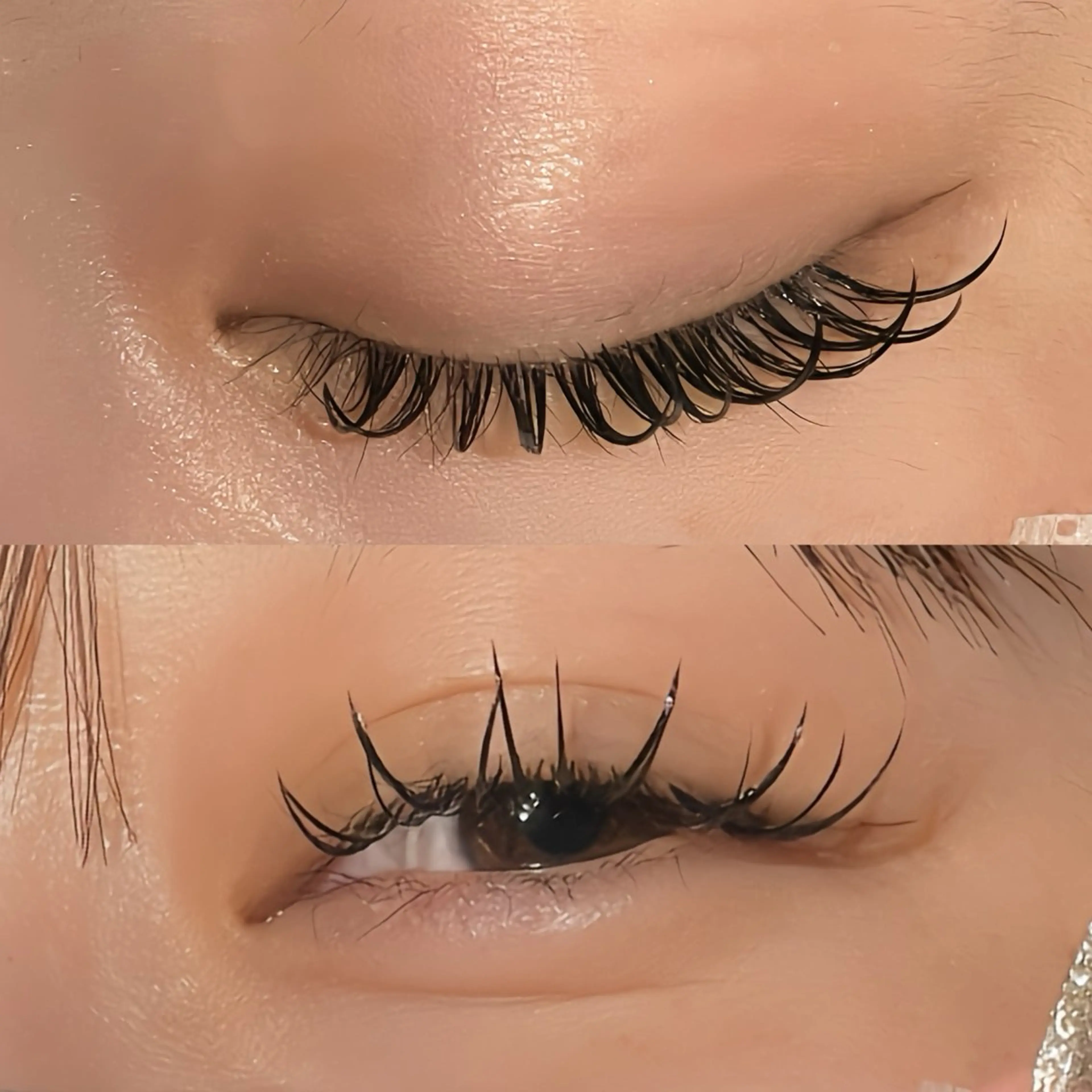 フラットラッシュ160本の写真