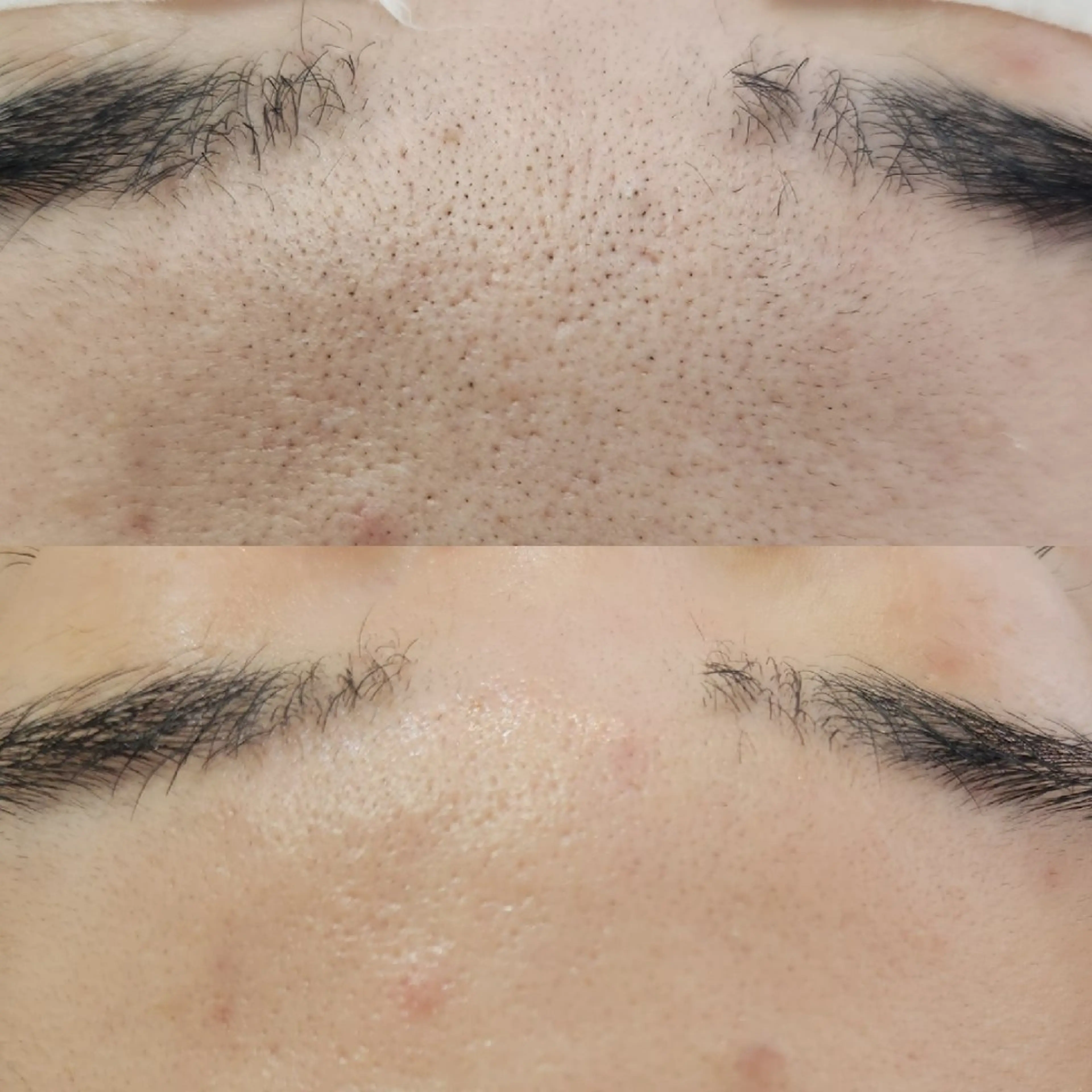 脱毛 Anacia Beauty Salon所属・美肌脱毛&毛穴専門 Anaciaのエステ・リラクイメージ