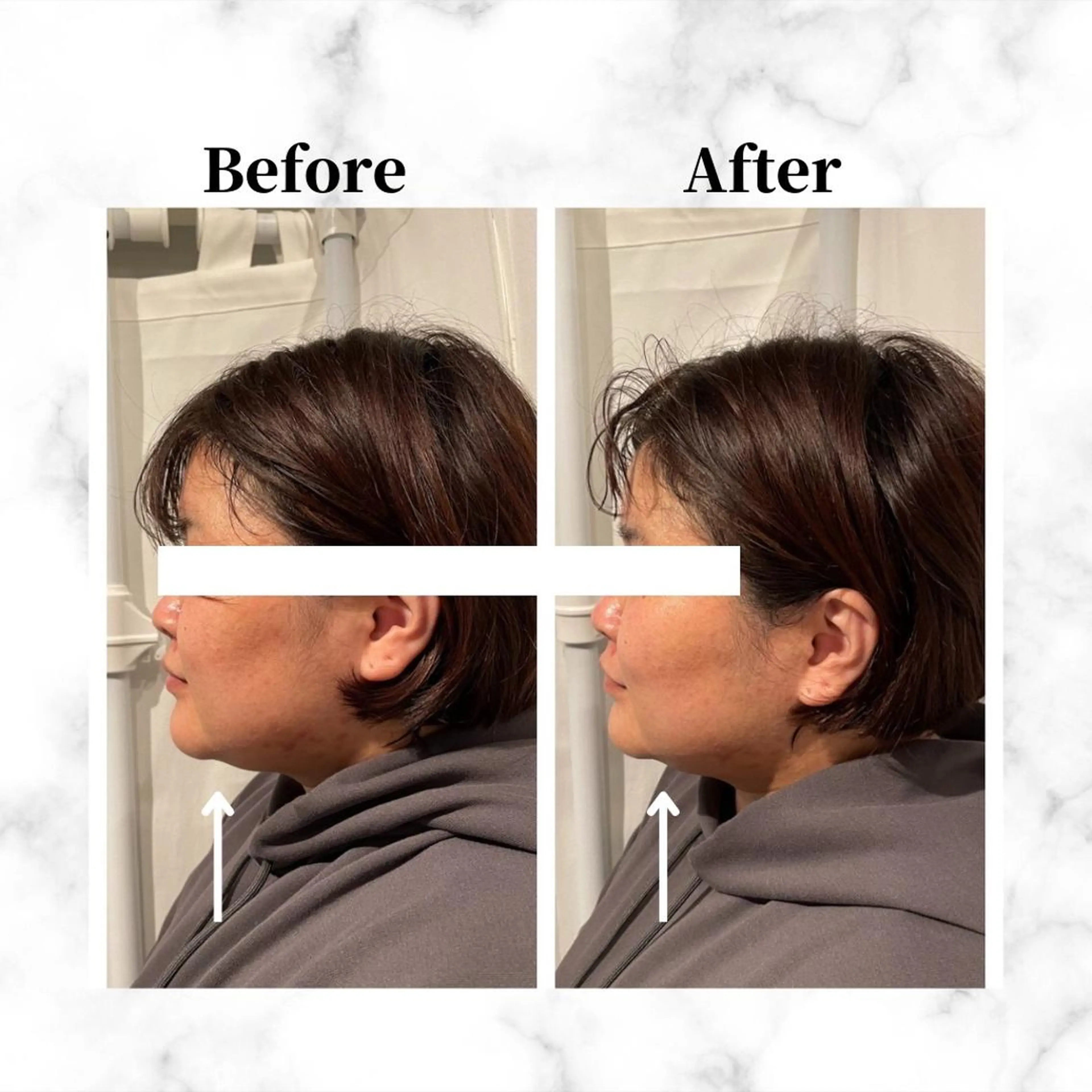 12Dハイフ💗 最強小顔のエステ・リラクイメージ