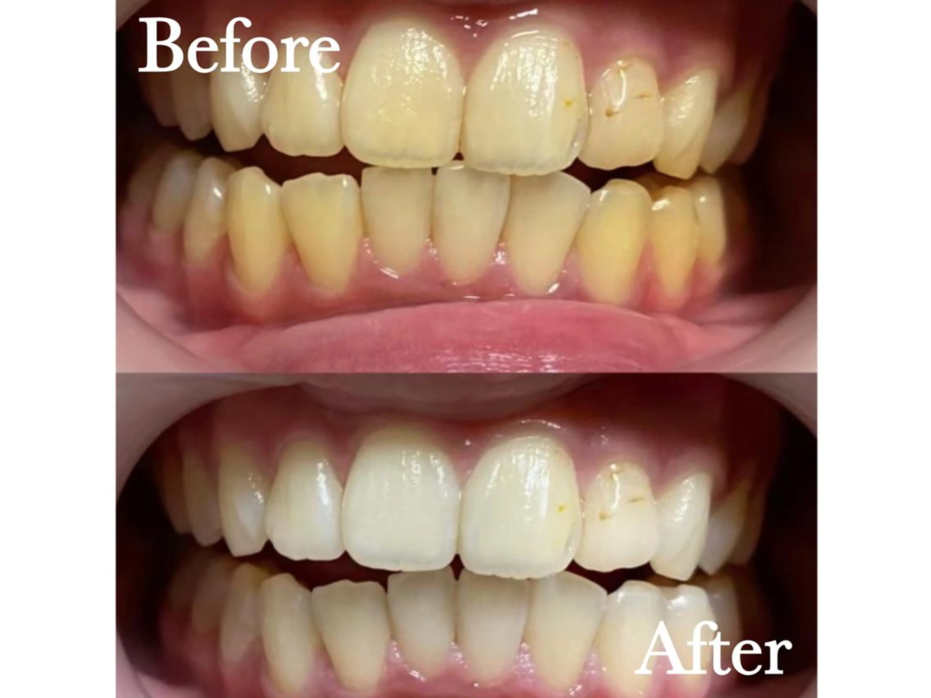 LBSホワイトニング 🌐渋谷店 公式のエステ・リラクイメージ