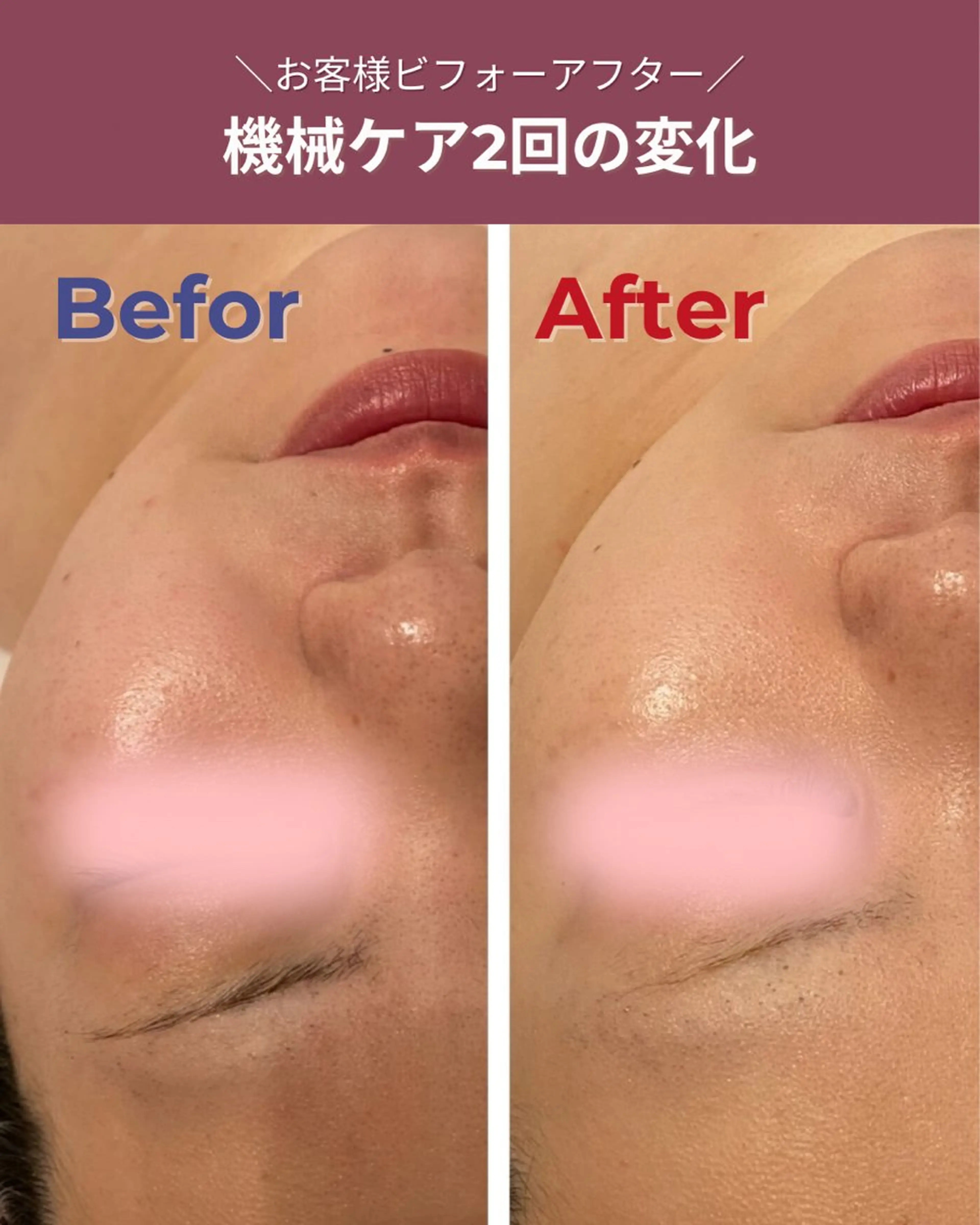 その他 肌質改善エステ RISMINのエステ・リラクイメージ