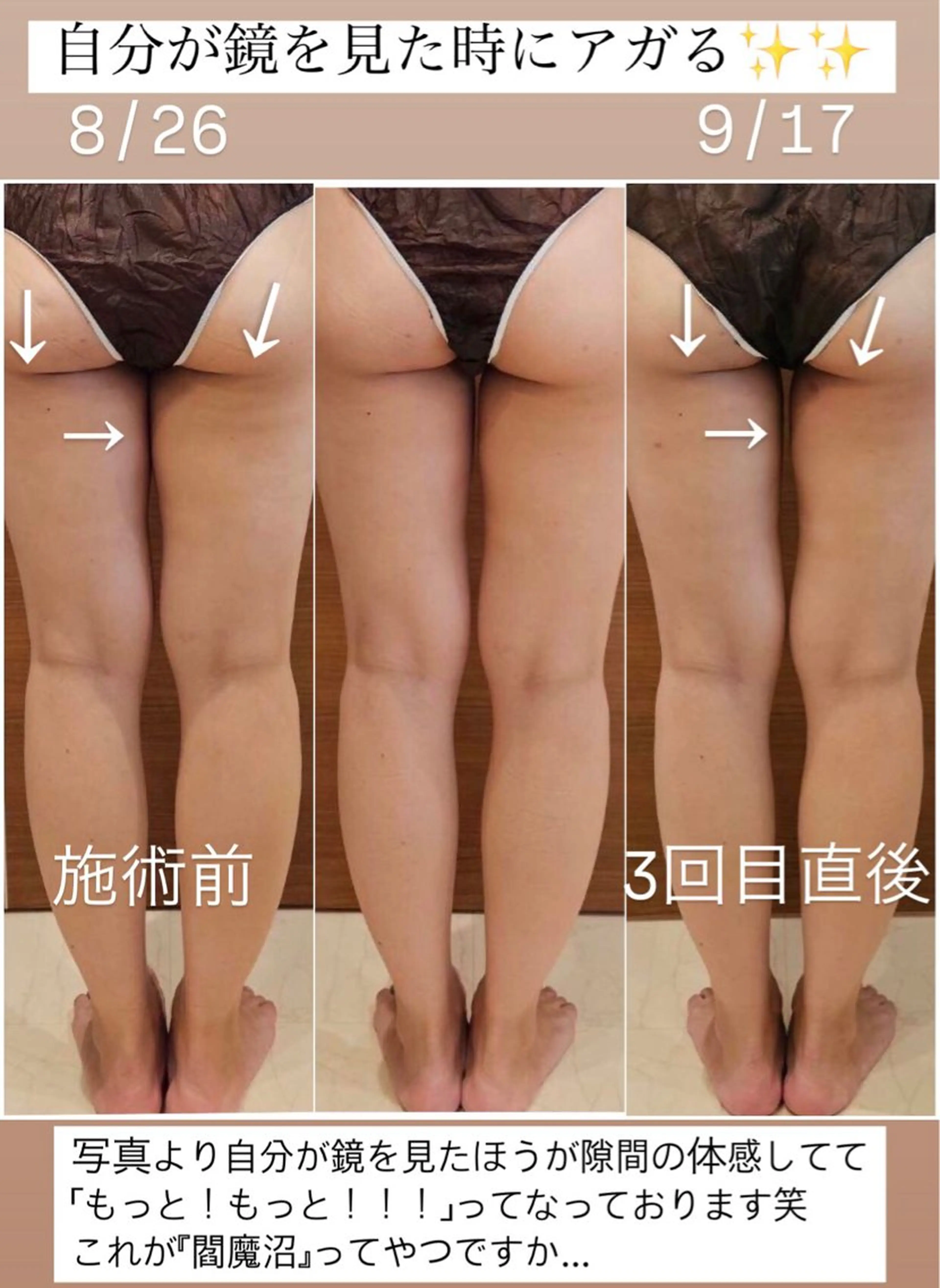 Wax/絹肌艶肌🌼 坂結加のエステ・リラクイメージ