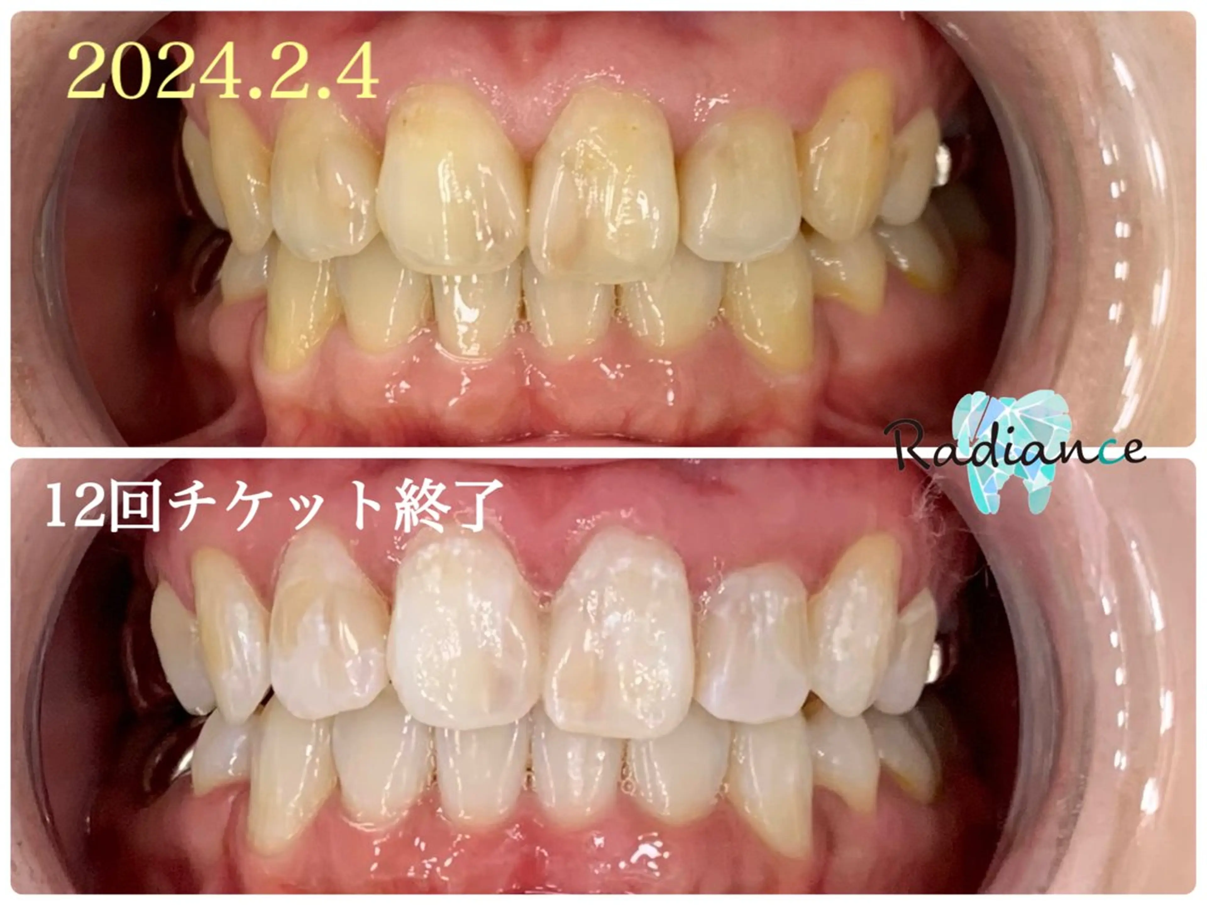 札幌ホワイトニング ラディアンス札幌駅店のその他イメージ