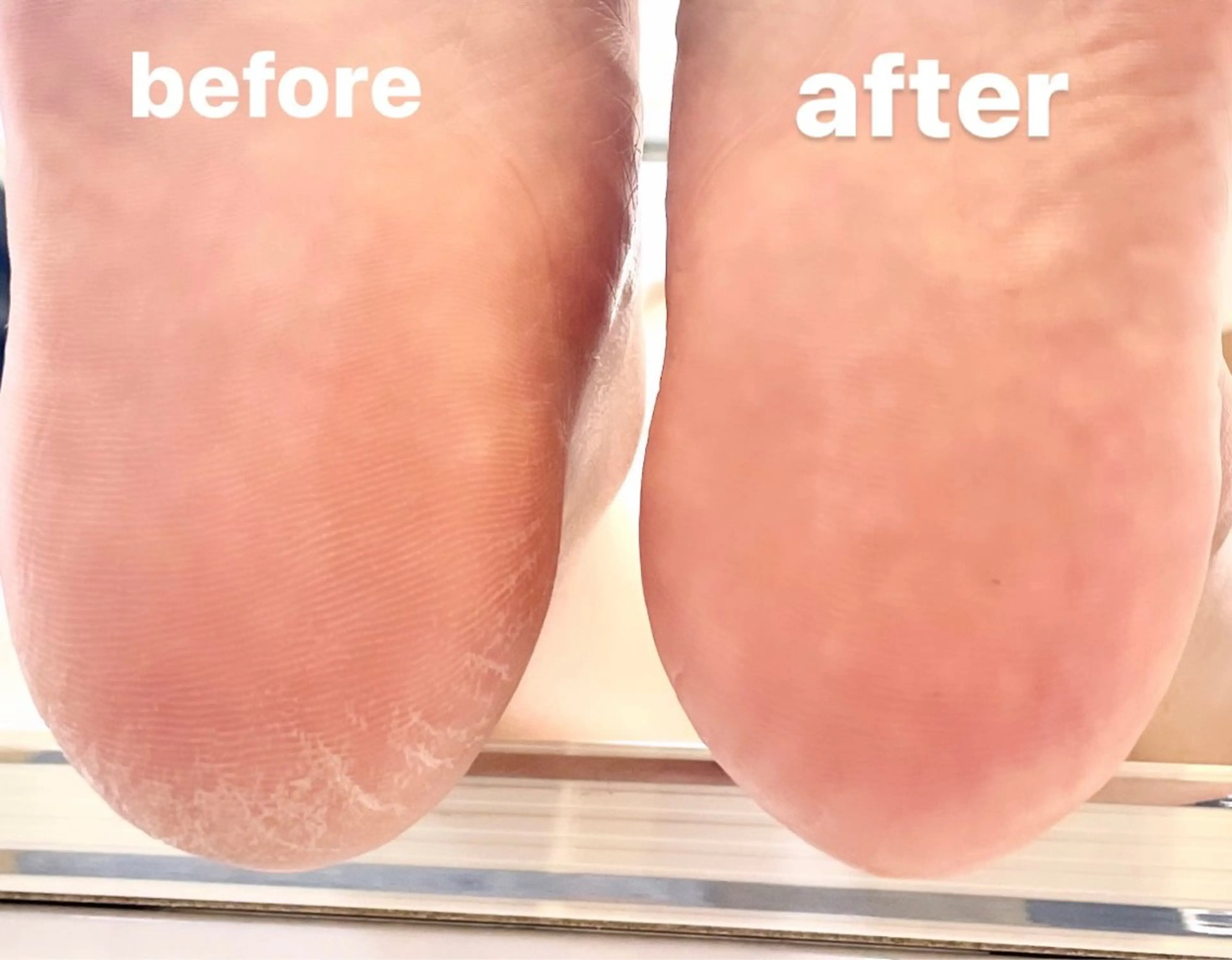 ネイル フットネイル フットネイル RISA joie nailのネイルデザイン