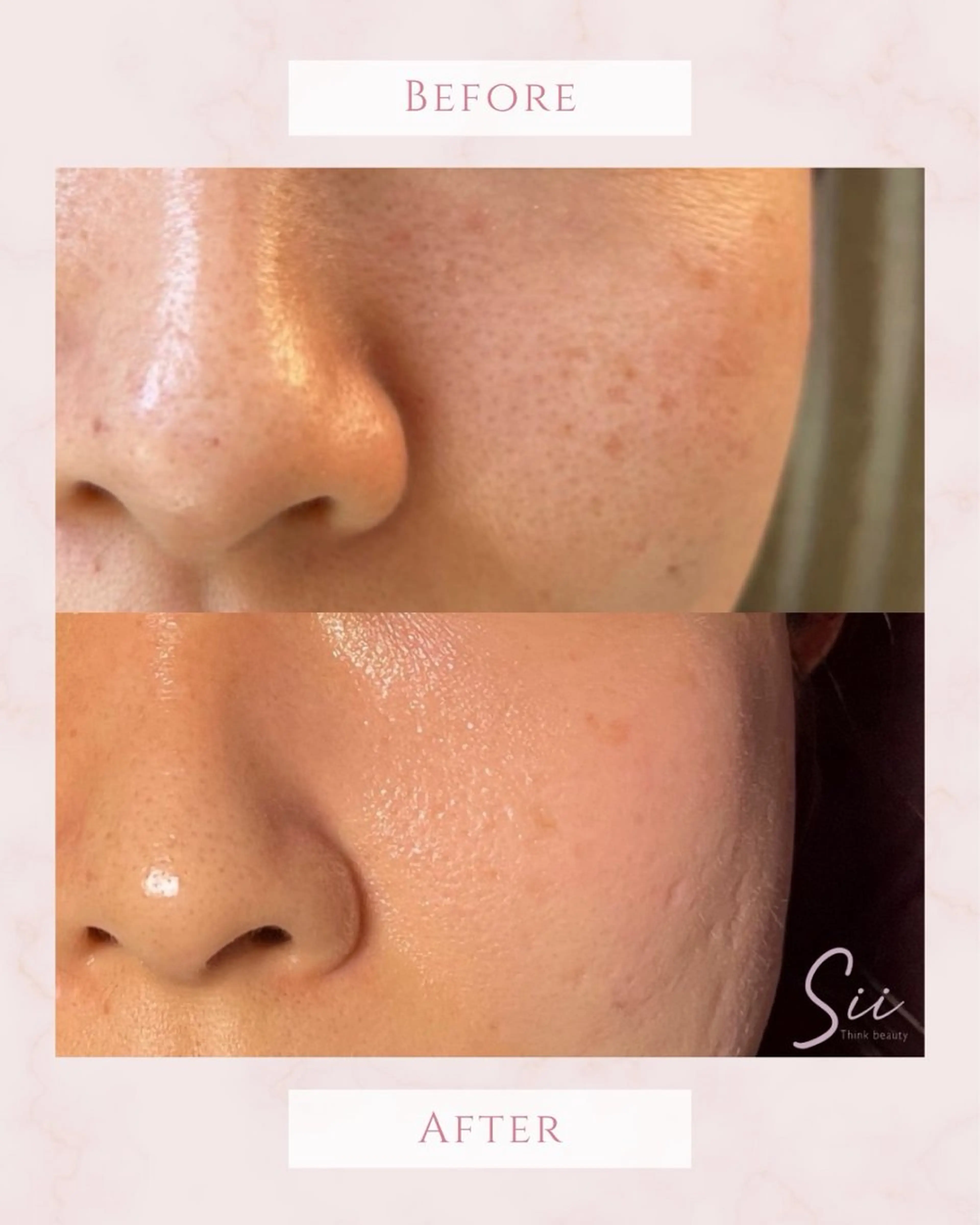 clochette misakoのエステ・リラクイメージ