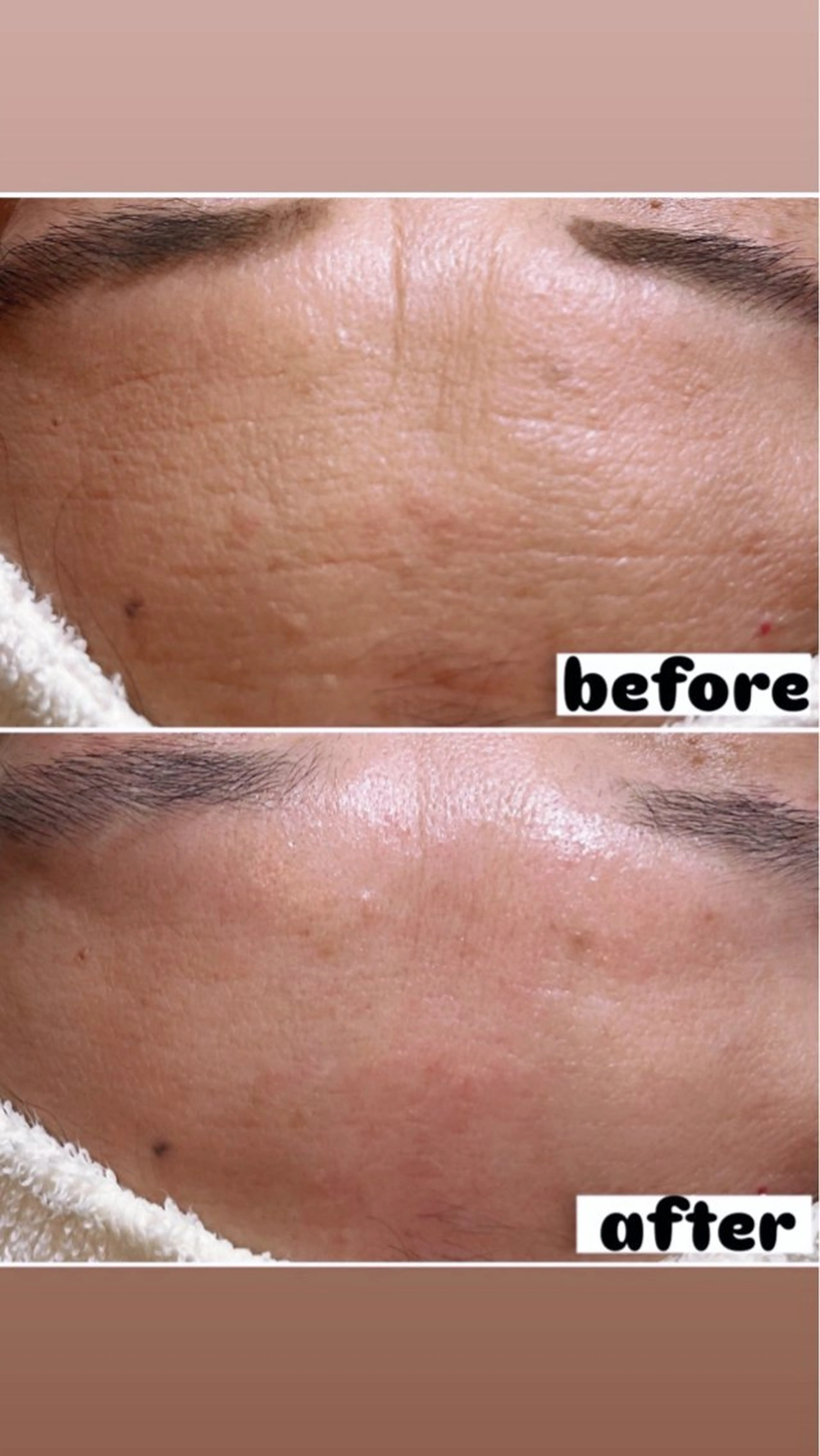 エステ リラク 🍀fleur🍀 杉浦のエステ・リラクイメージ