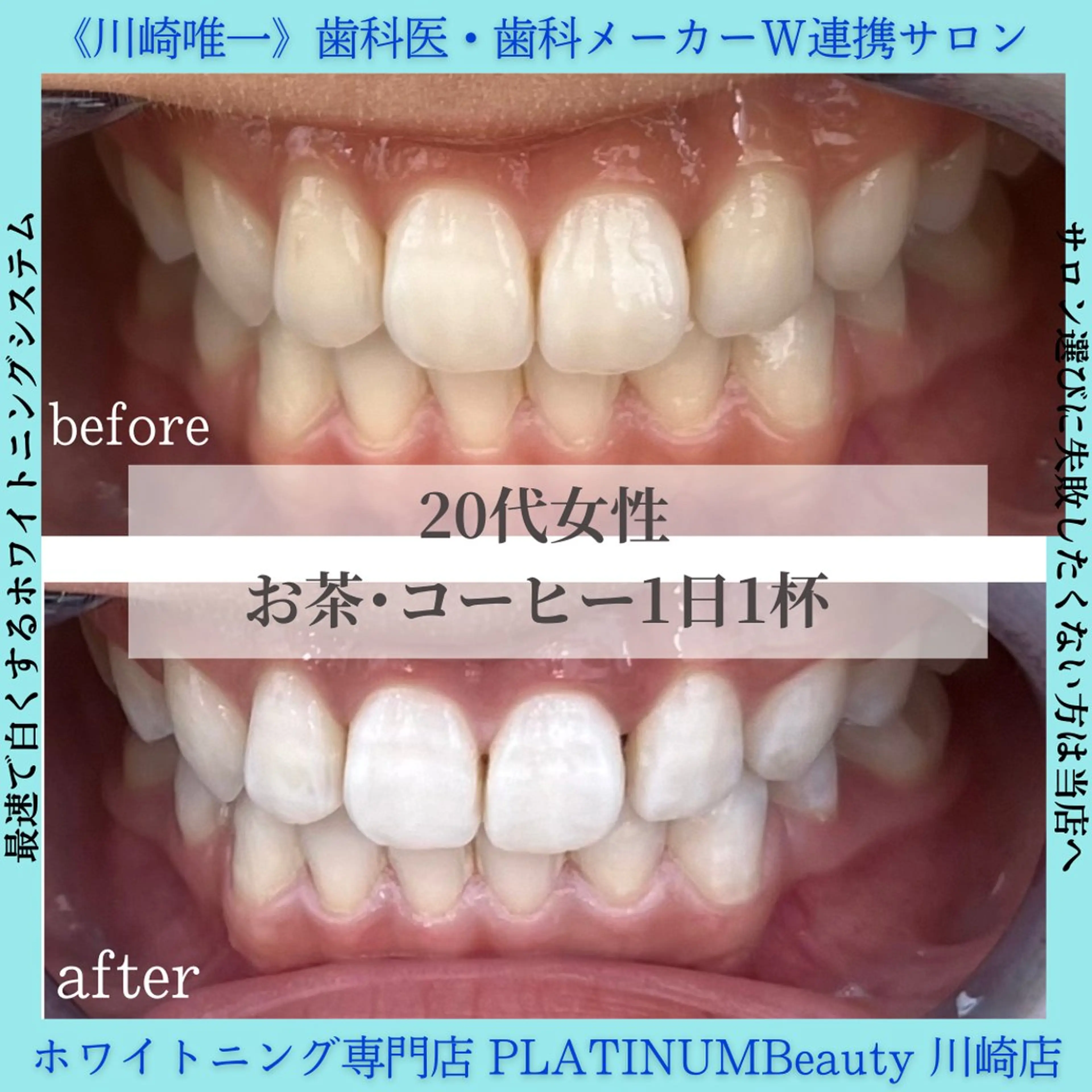 PLATINUM Beauty 川崎店のエステ・リラクイメージ