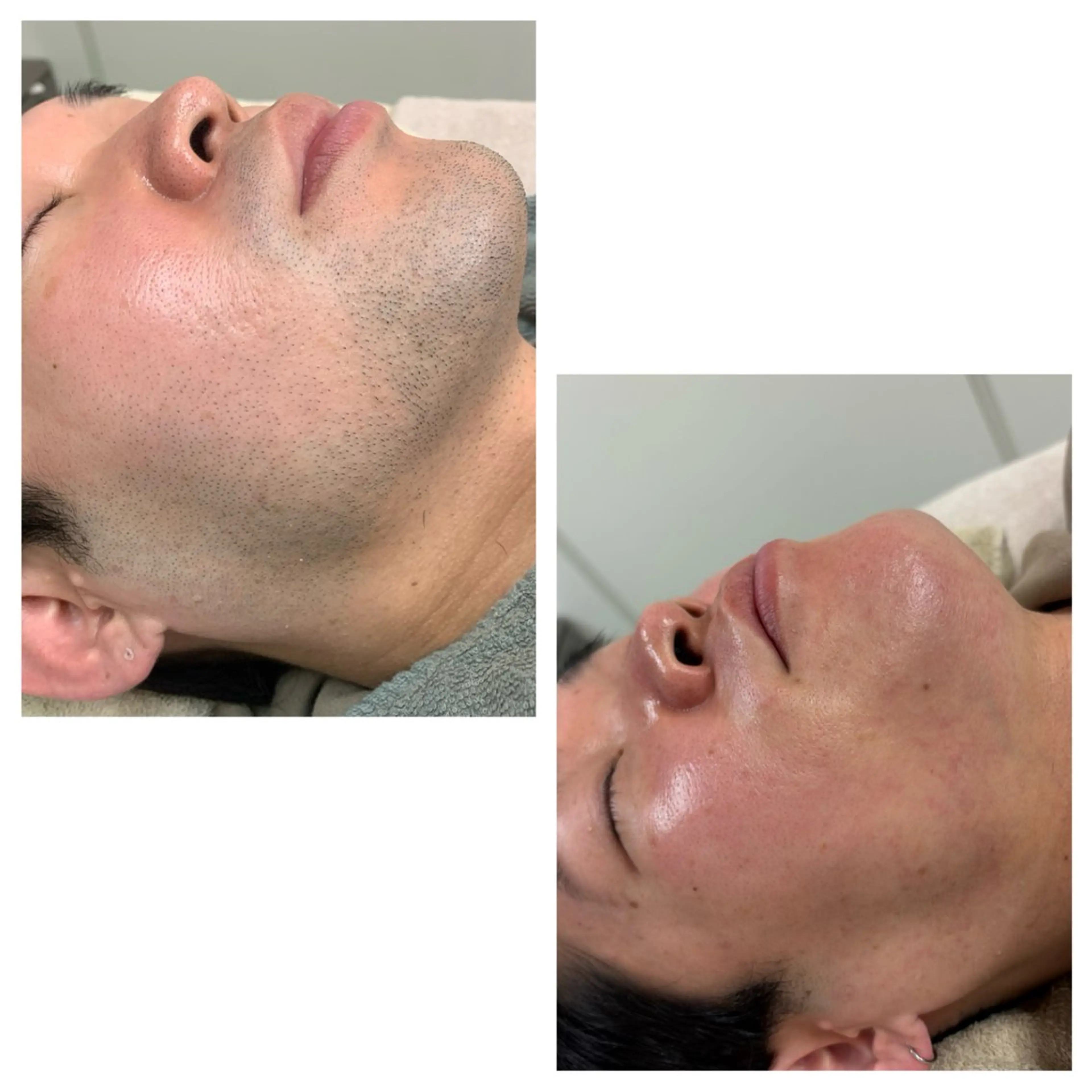 メンズ 脱毛 MISEREL岡崎店 Ayaのエステ・リラクイメージ