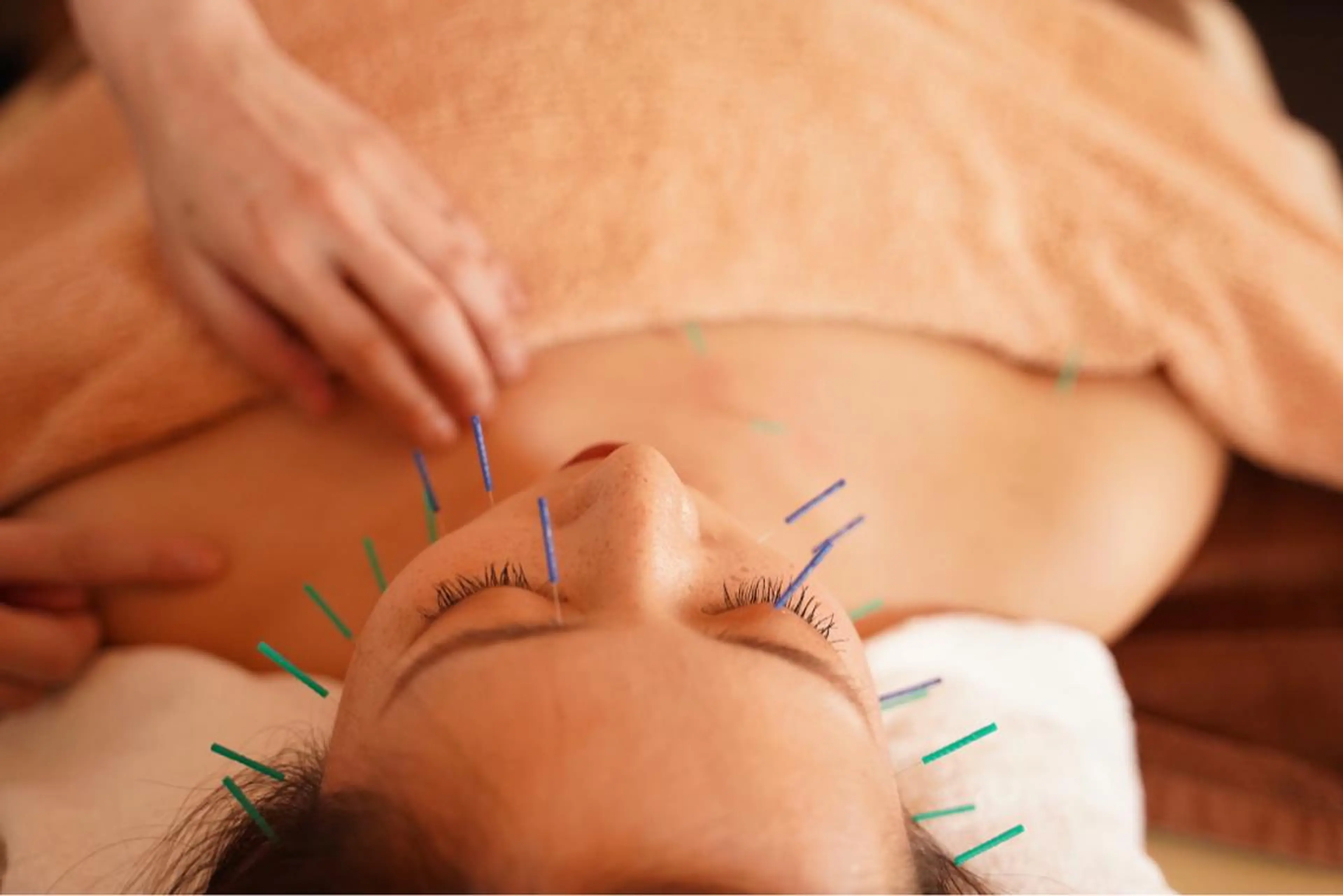 エステ リラク 美容鍼・鍼灸専門❤✨ 近藤めぐみのエステ・リラクイメージ