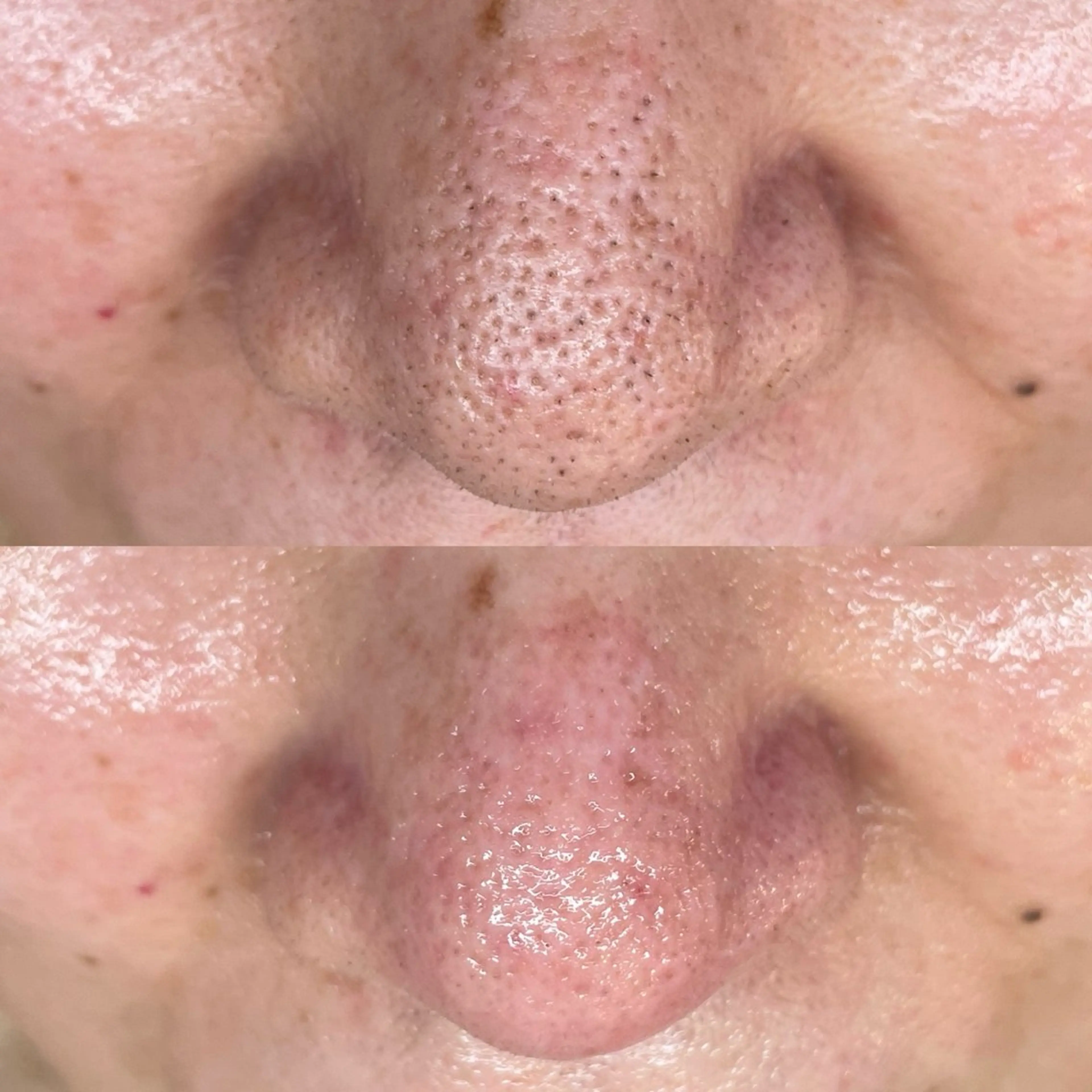 エステ 毛穴・頭皮 専門店💪のその他イメージ