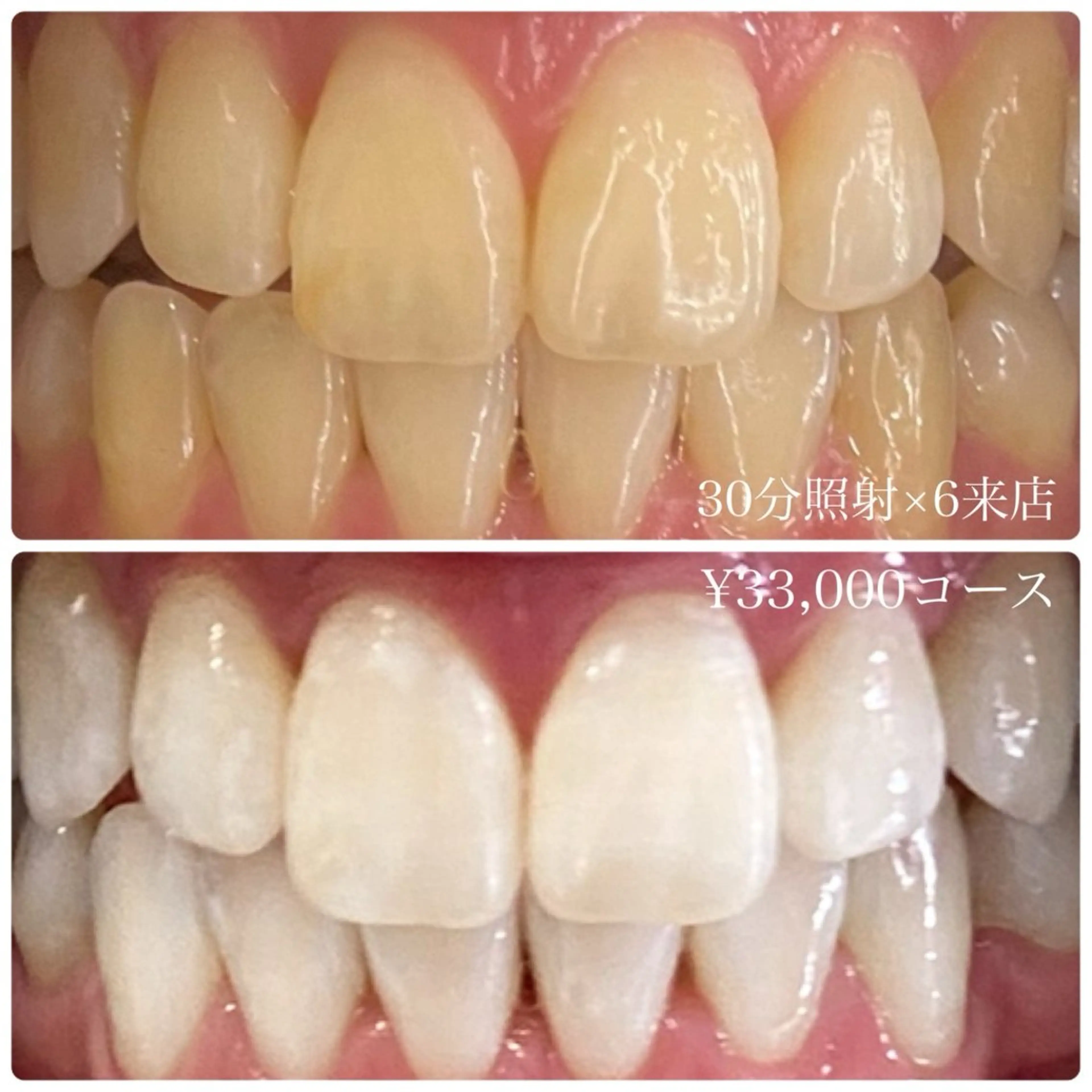 その他 PLATINUM Beauty 横浜店所属・ホワイトニングルーム 横浜店のその他イメージ