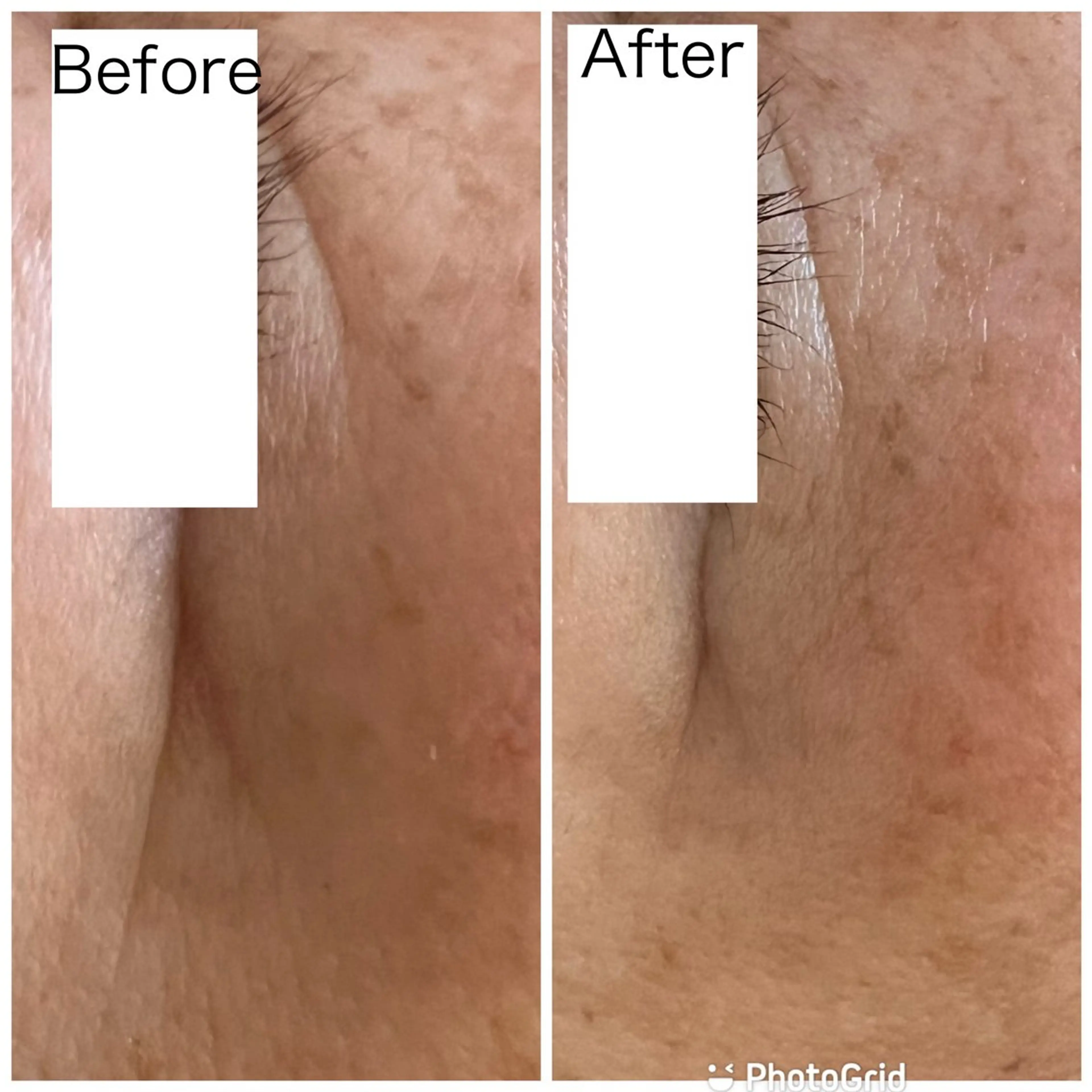 プライベートサロン Ponolaのエステ・リラクイメージ