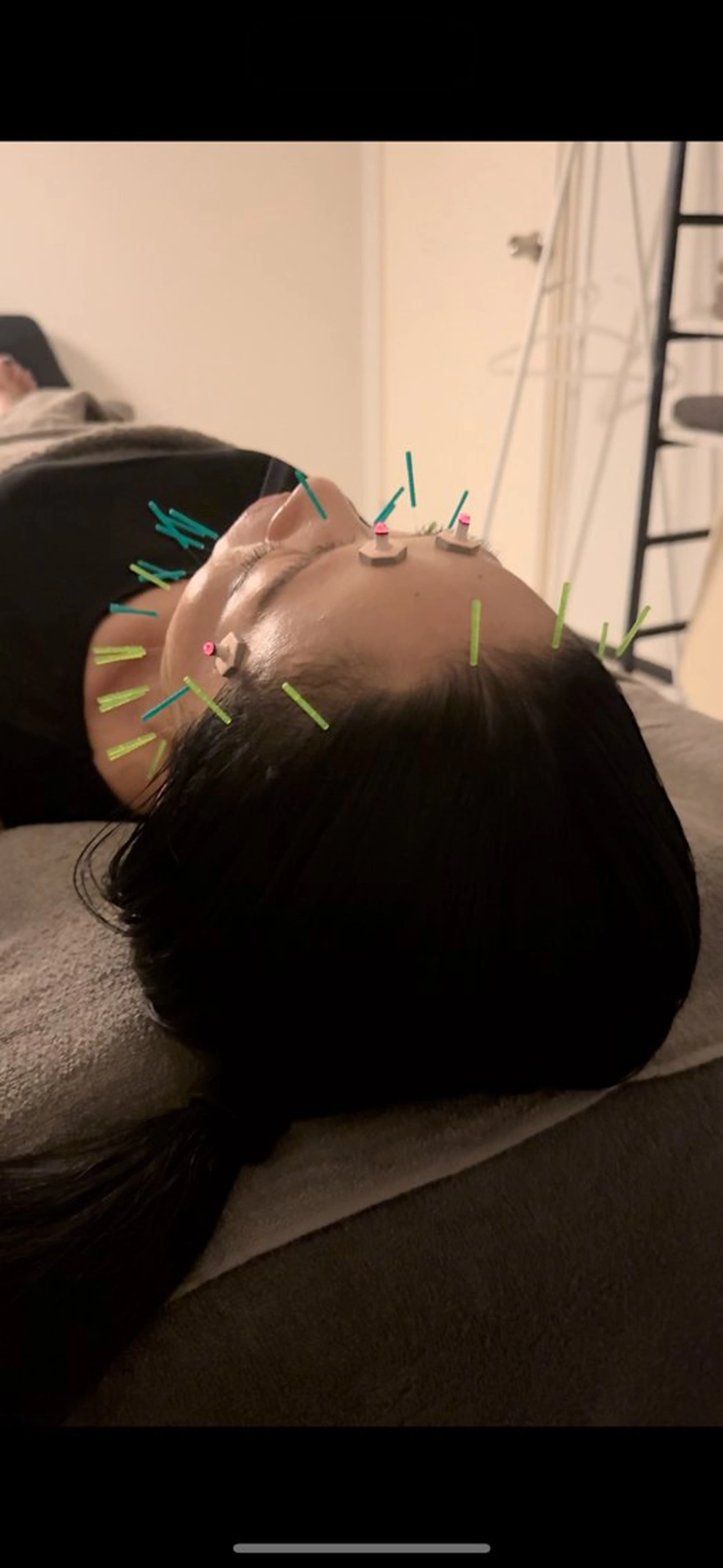 エステ リラク 美容鍼×小顔矯正 ×美容整体 浜川泰仁のエステ・リラクイメージ