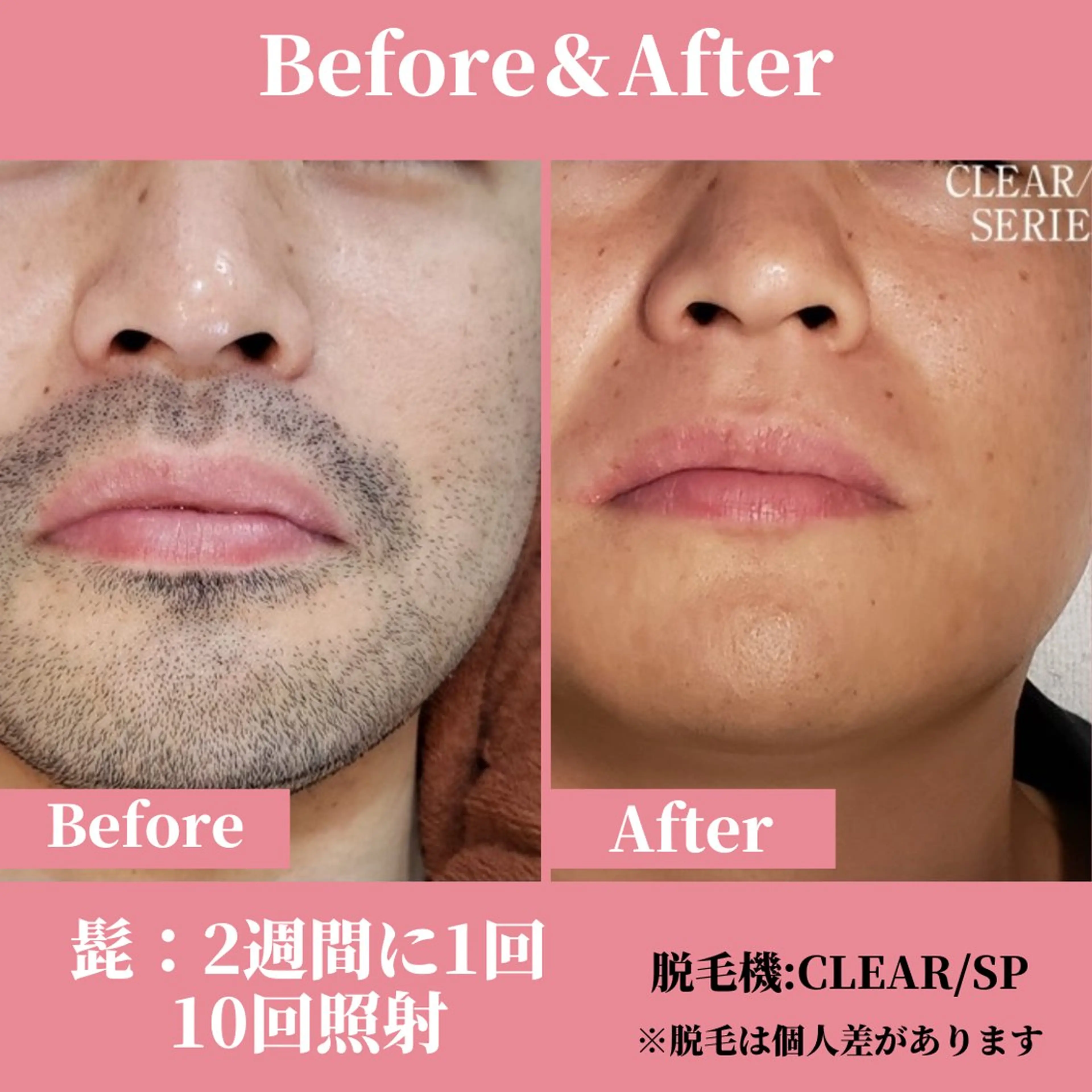 メンズ 有人型セルフサロン 脱毛／痩身／美顔のエステ・リラクイメージ