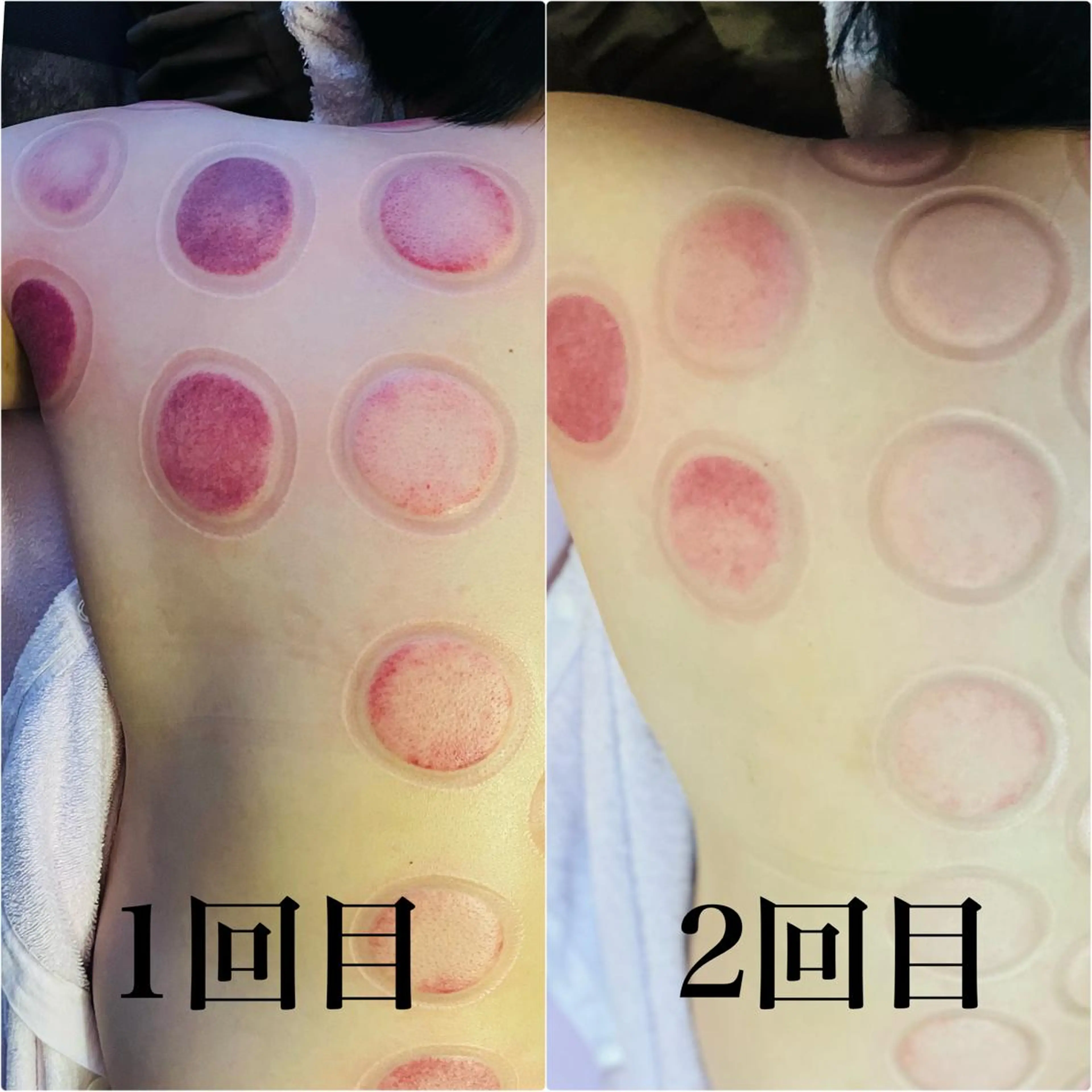 アロマ･美容鍼･カッ ピング「麗」鍼灸院のエステ・リラクイメージ