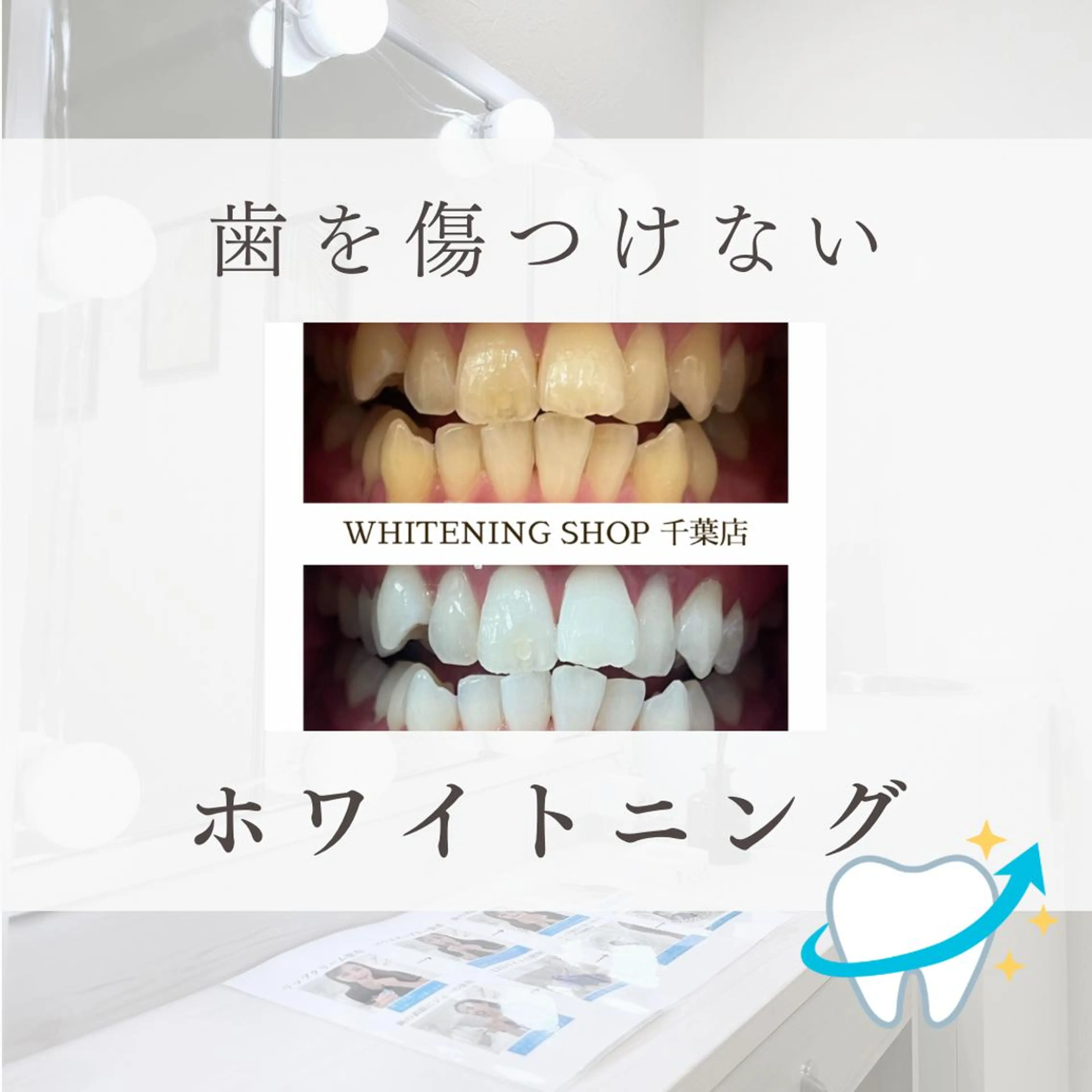 メンズ その他 ホワイトニング ショップ千葉店のその他イメージ