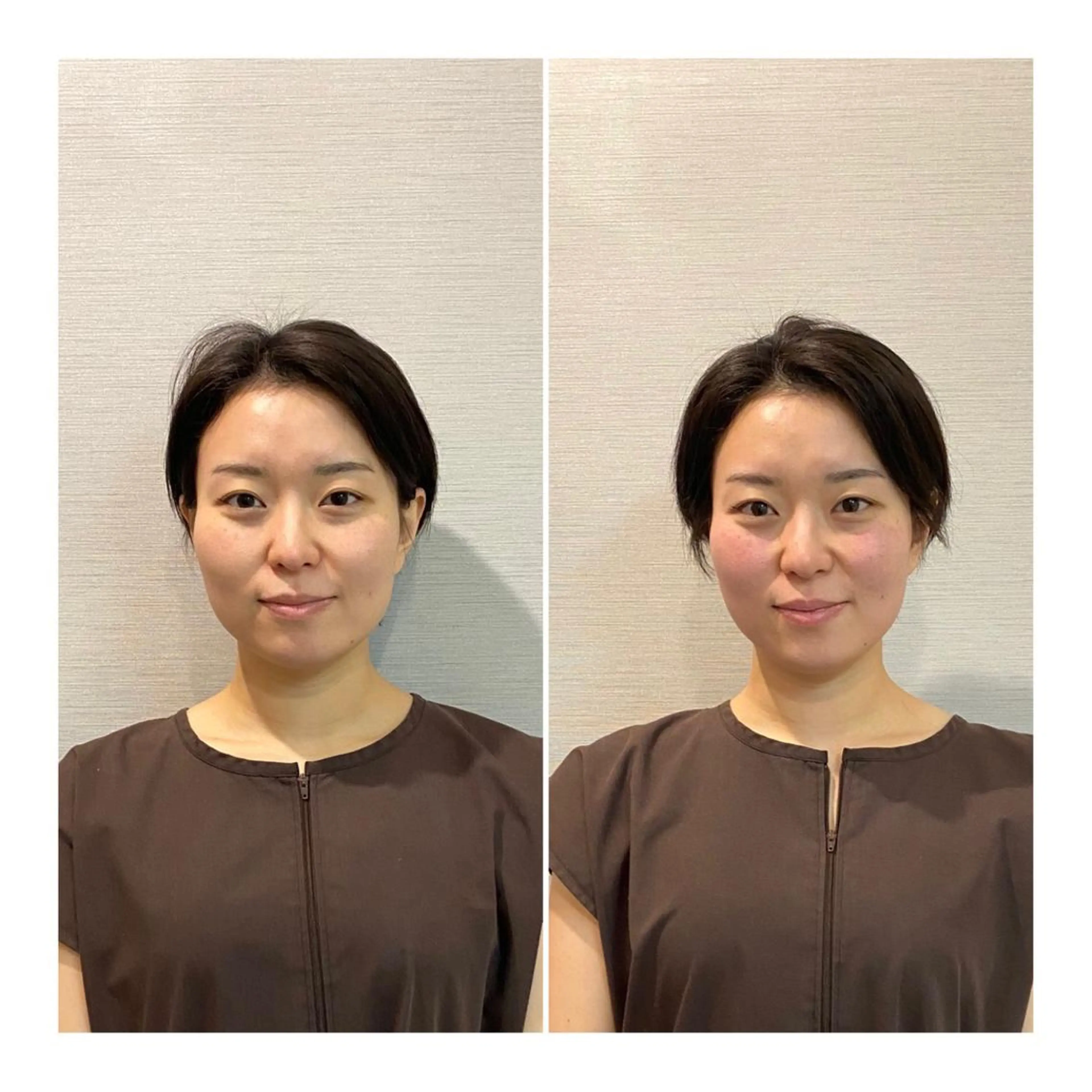 即小顔♥️美容鍼× ハーブピーリングのその他イメージ