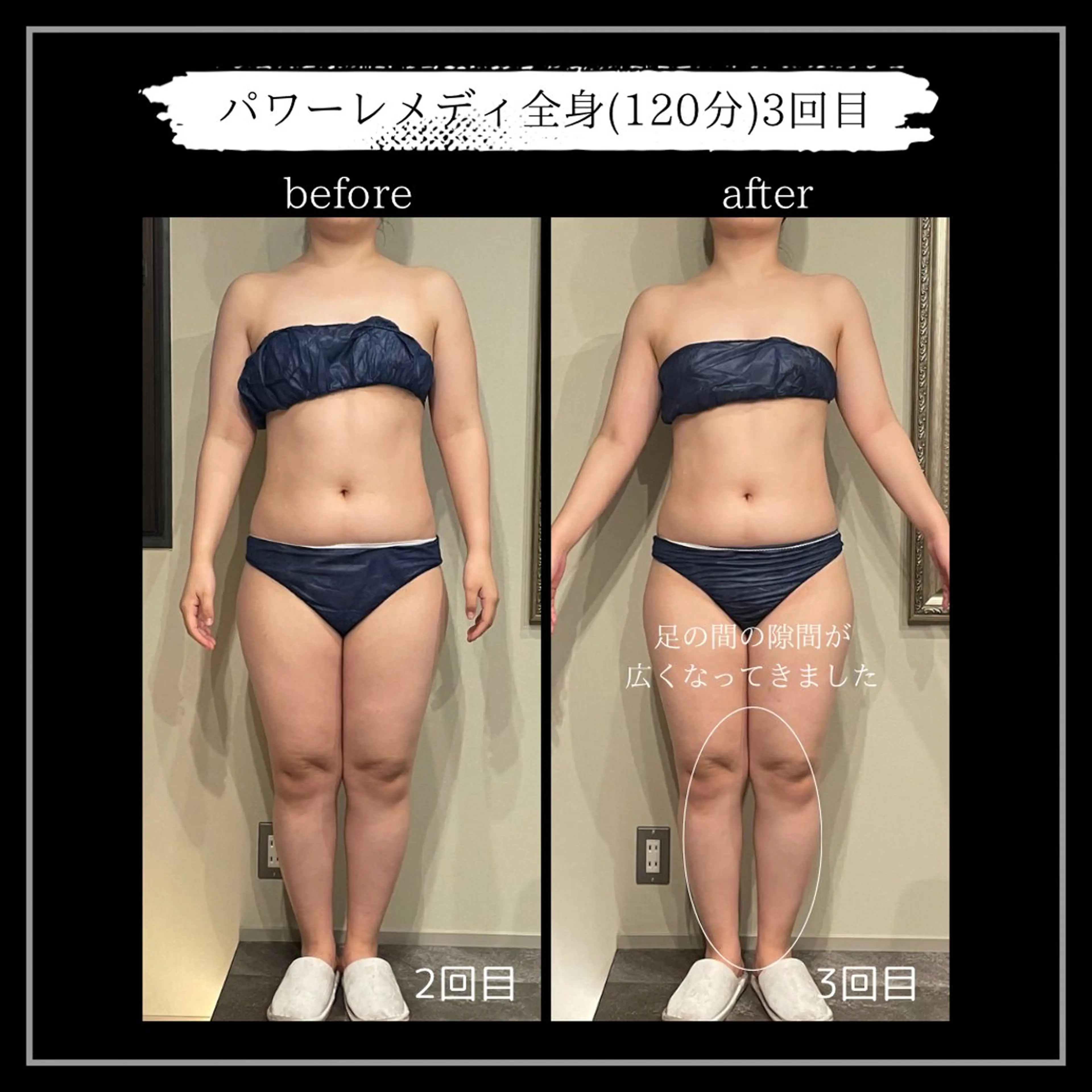 オフ:オン 全身筋膜マッサージのエステ・リラクイメージ